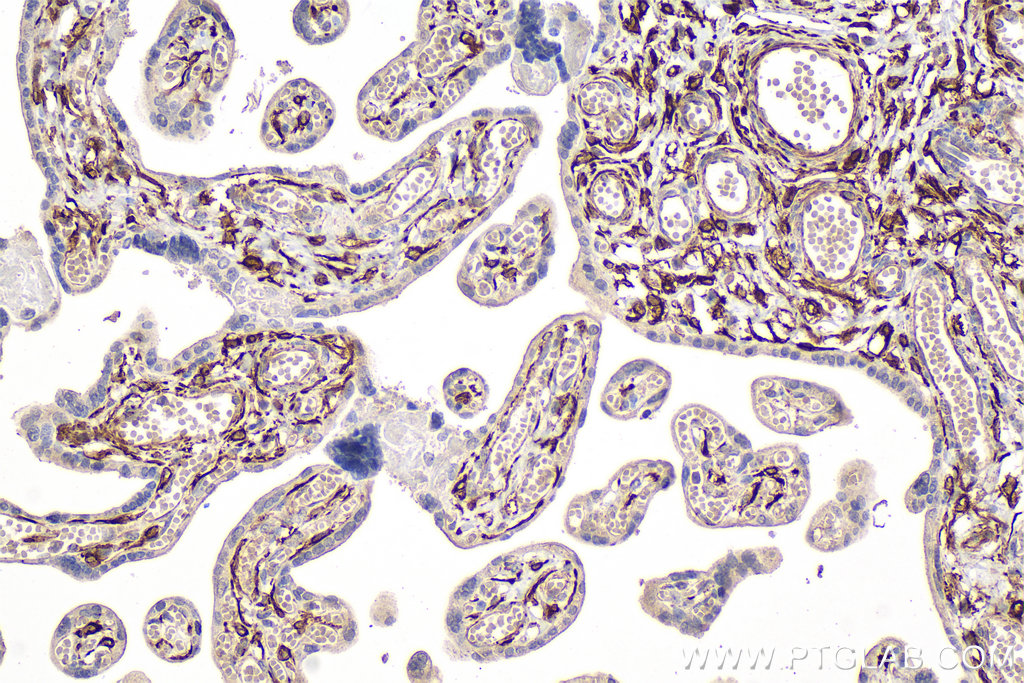 Immunohistochemistry (IHC) staining of human placenta tissue using Desmin Monoclonal antibody (67793-1-Ig)