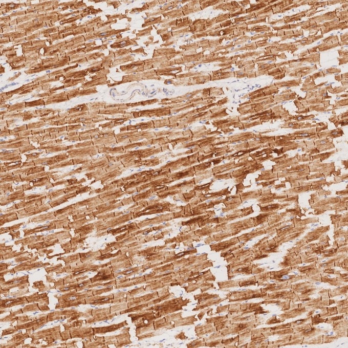 Immunohistochemistry (IHC) staining of human heart tissue using Desmin Monoclonal antibody (67793-1-Ig)