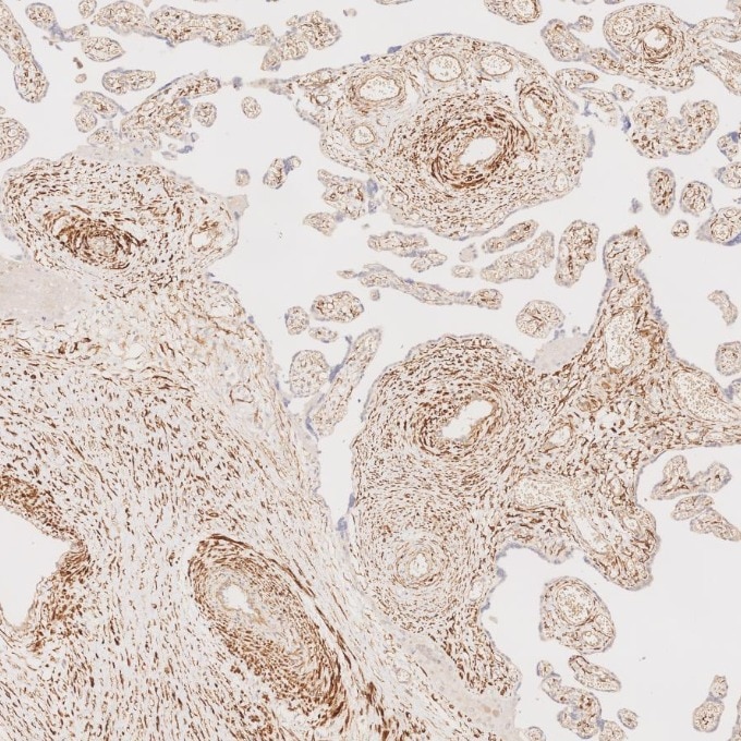 Immunohistochemistry (IHC) staining of human placenta tissue using Desmin Monoclonal antibody (67793-1-Ig)