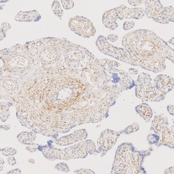 Immunohistochemistry (IHC) staining of human placenta tissue using Desmin Monoclonal antibody (67793-1-Ig)