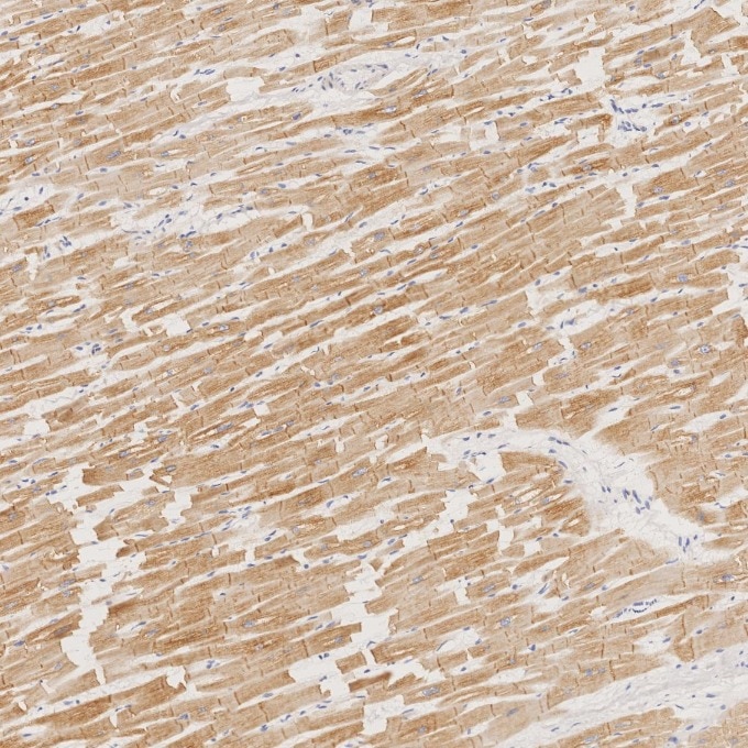 Immunohistochemistry (IHC) staining of human heart tissue using Desmin Monoclonal antibody (67793-1-Ig)