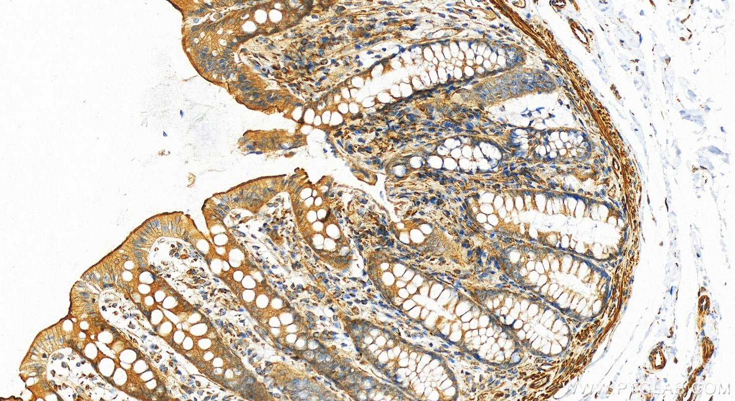 Immunohistochemistry (IHC) staining of human normal colon using Desmin Recombinant antibody (82748-1-RR)