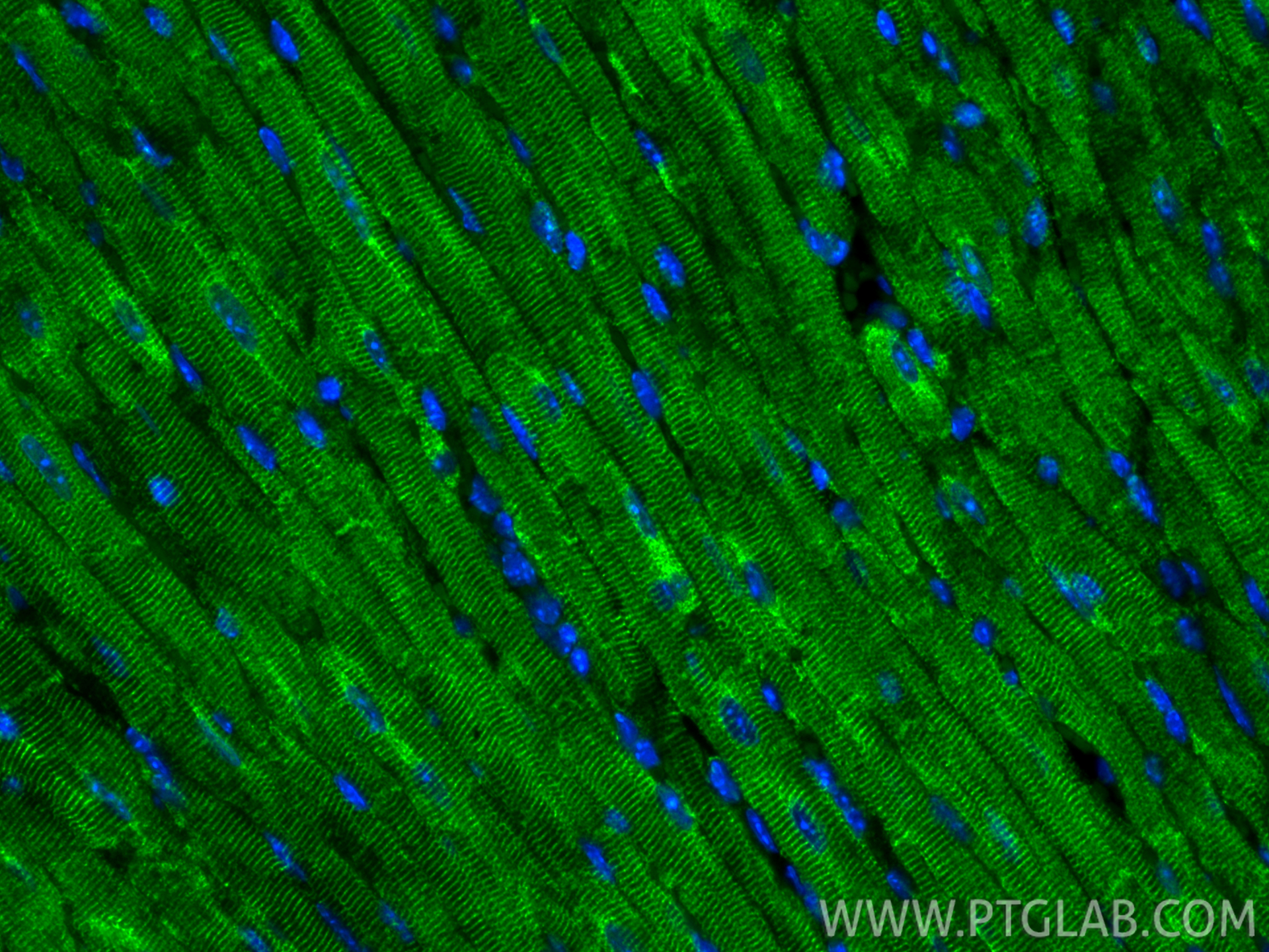 Immunofluorescence (IF) / fluorescent staining of mouse heart tissue using Desmin Recombinant antibody (82748-1-RR)