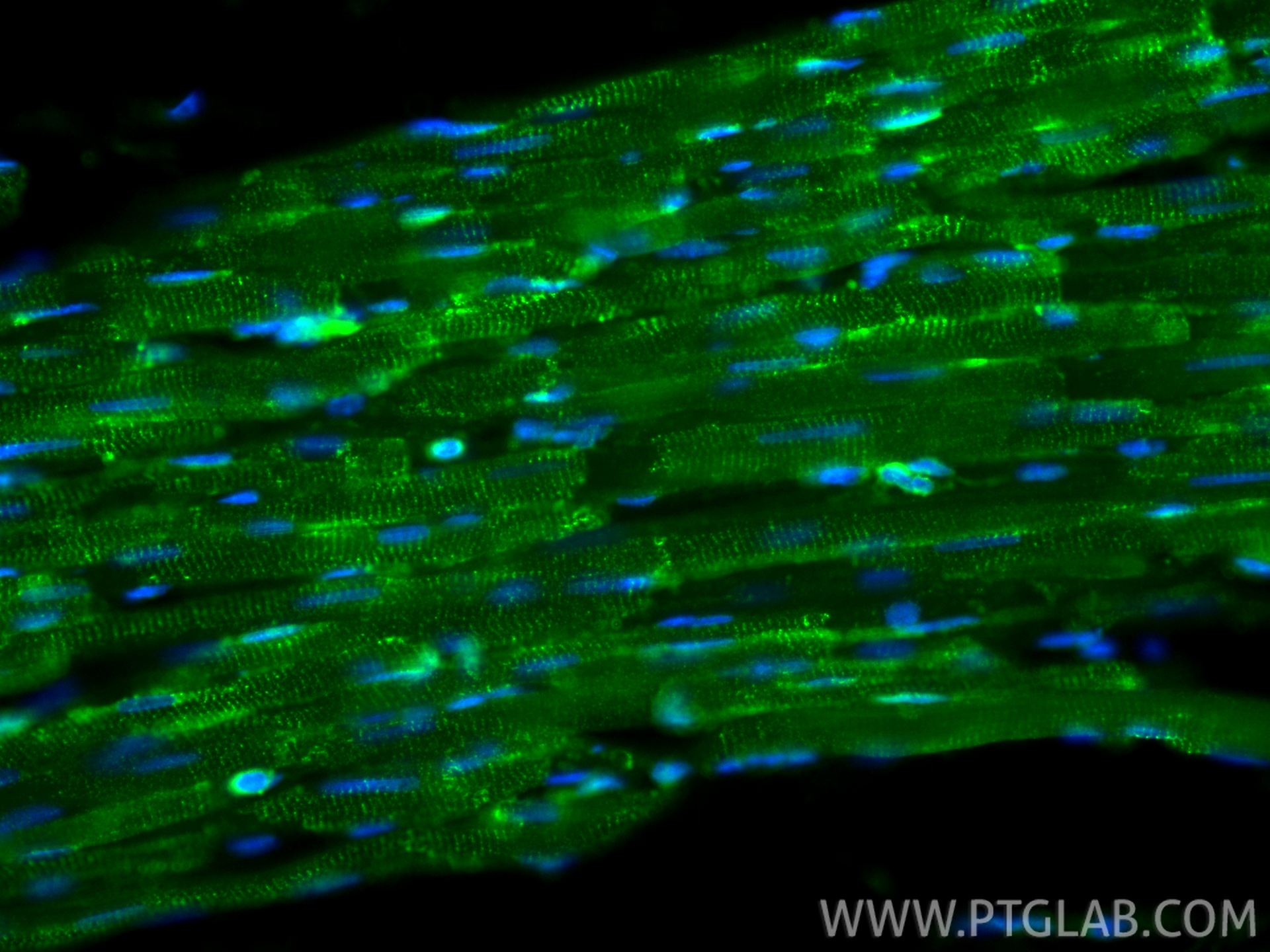 Immunofluorescence (IF) / fluorescent staining of rat heart tissue using Desmin Recombinant antibody (82748-1-RR)