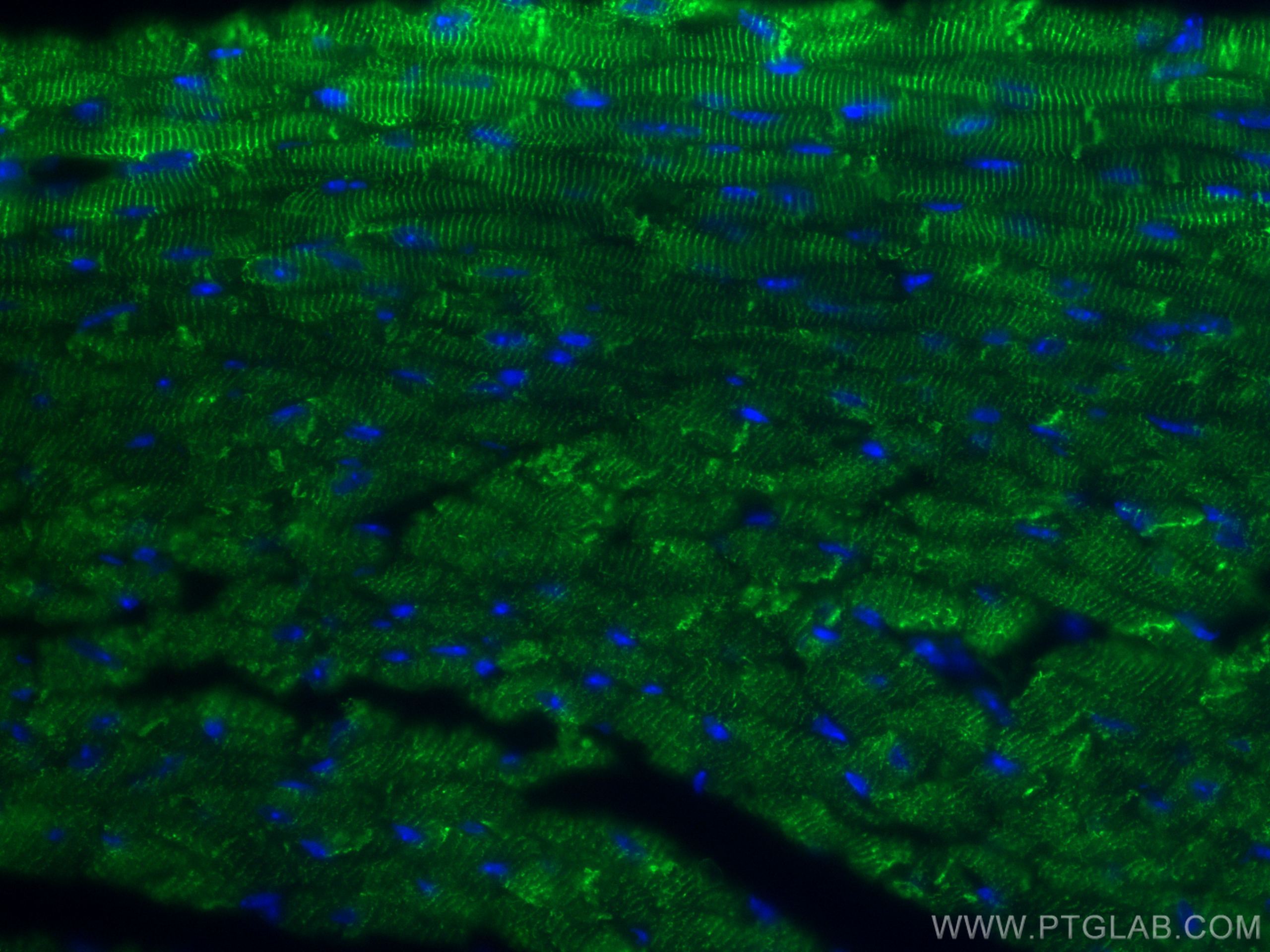 Immunofluorescence (IF) / fluorescent staining of mouse heart tissue using CoraLite® Plus 488-conjugated Desmin Polyclonal an (CL488-16520)
