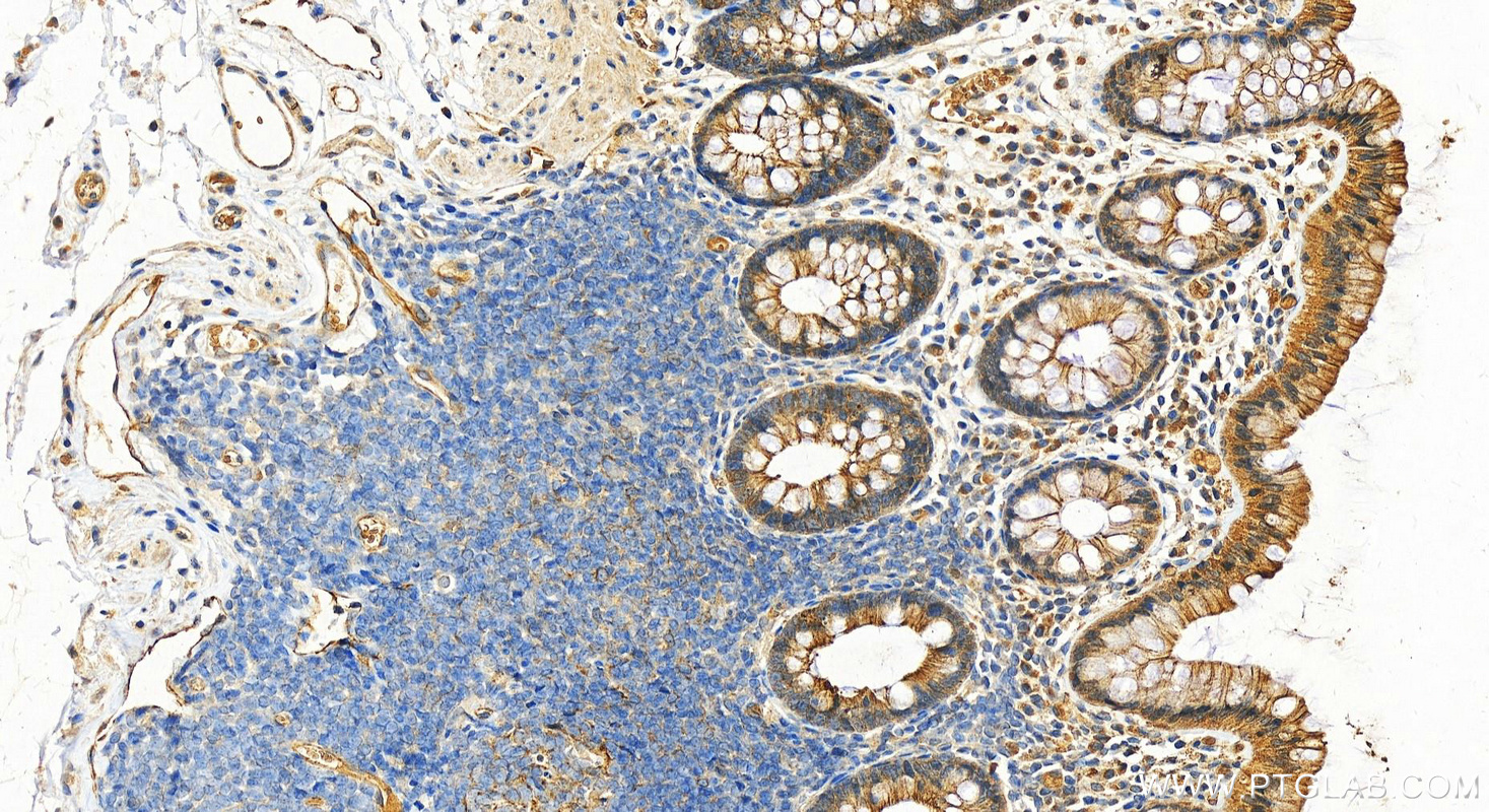 Immunohistochemistry (IHC) staining of human normal colon using Desmoplakin Polyclonal antibody (25318-1-AP)