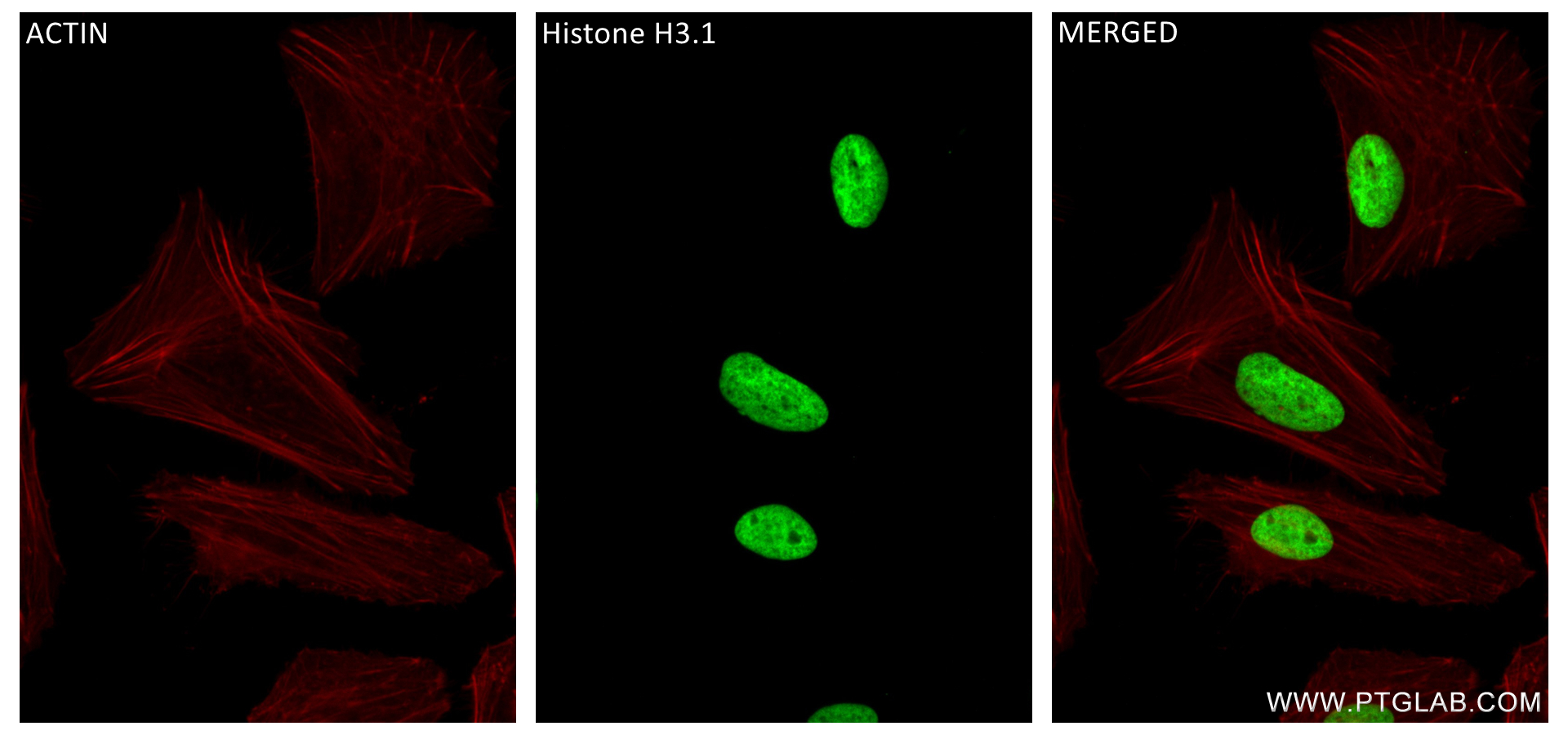 Immunofluorescence (IF) / fluorescent staining of HeLa cells using Di-Methyl-Histone H3 (Arg2)  Recombinant antibody (84702-1-RR)