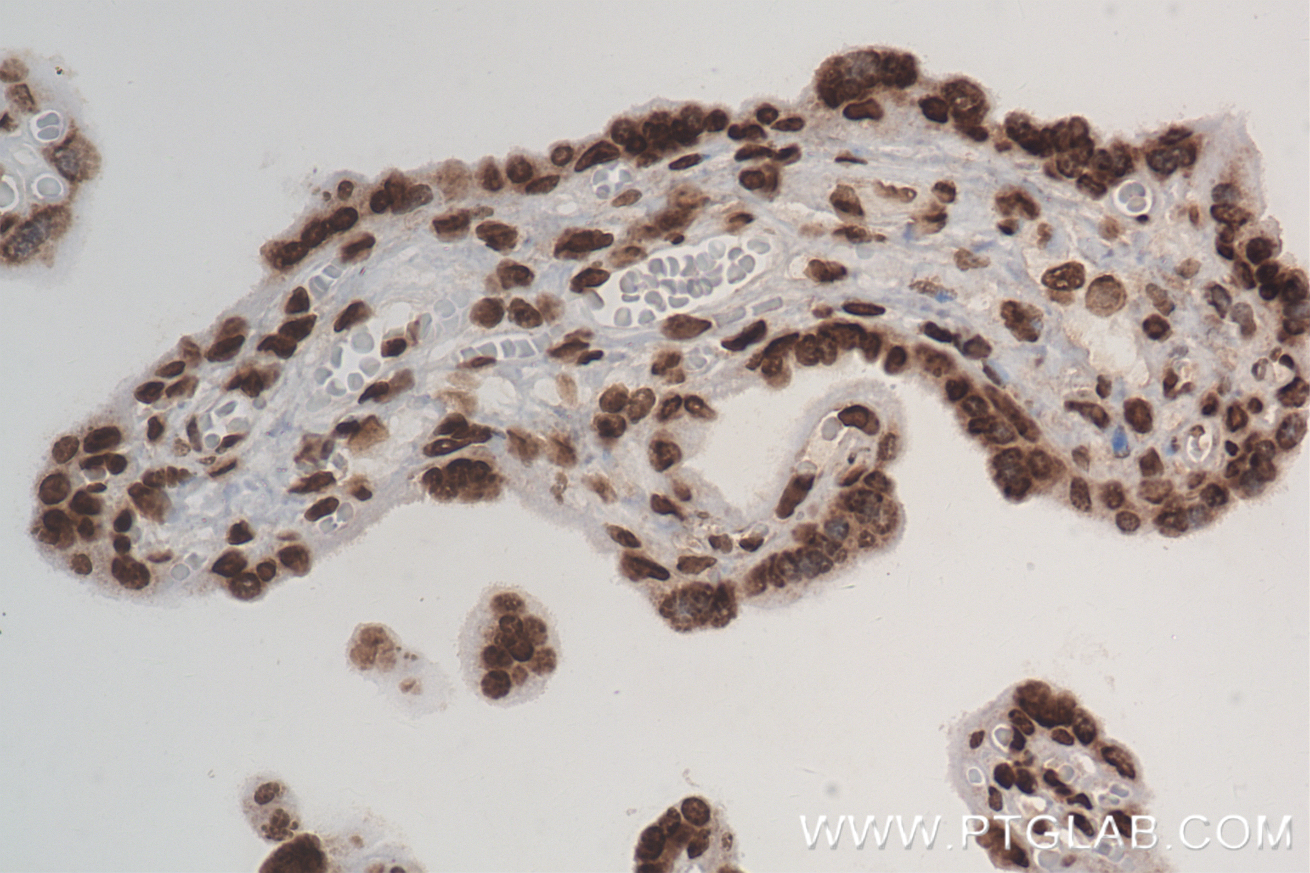 Immunohistochemistry (IHC) staining of human placenta tissue using Di-Methyl-Histone H3 (Arg2) Recombinant antibody (84702-1-RR)