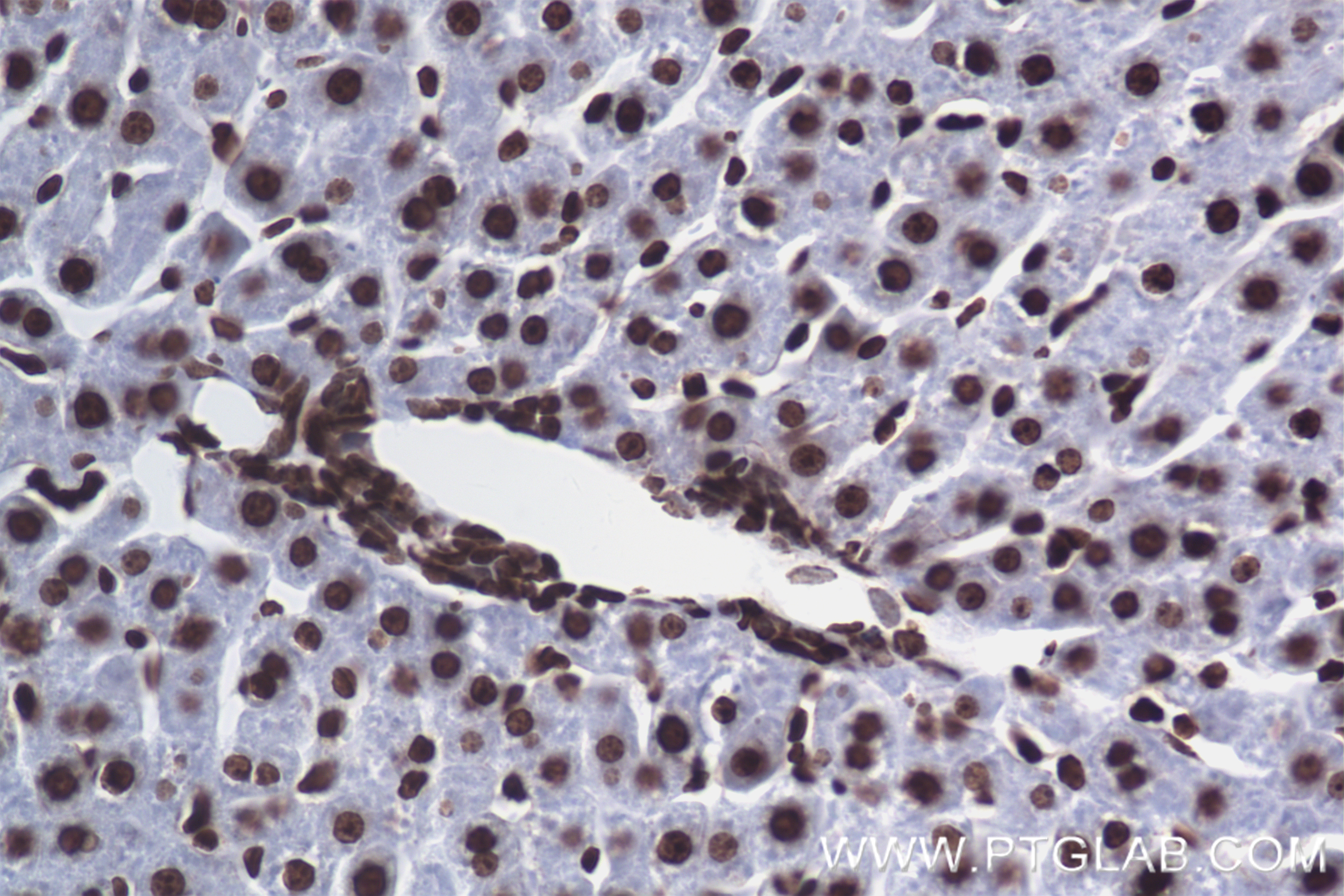Immunohistochemistry (IHC) staining of rat liver tissue using Di-Methyl-Histone H3 (Arg2) Recombinant antibody (84702-1-RR)