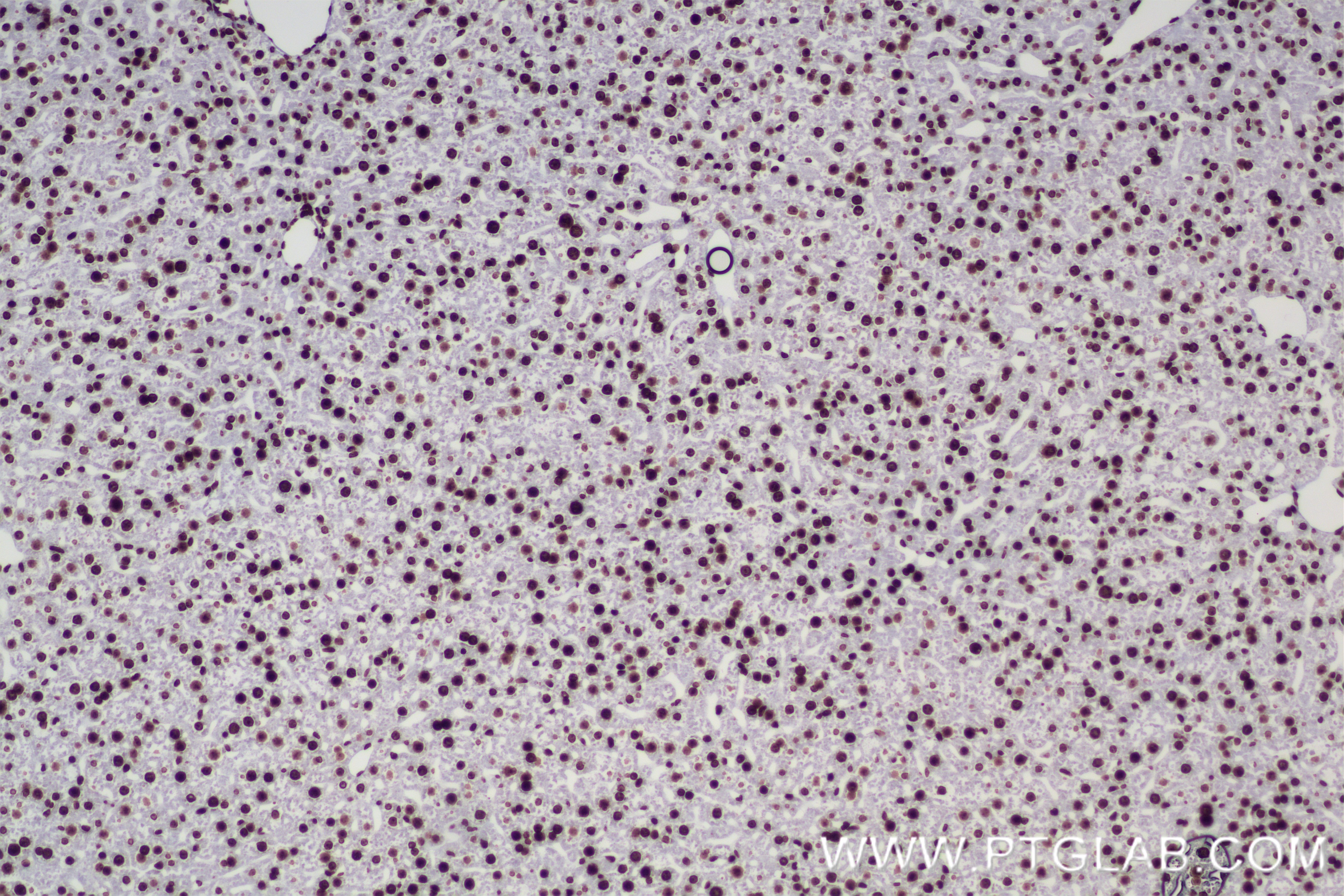 Immunohistochemistry (IHC) staining of mouse liver tissue using Di-Methyl-Histone H3 (Arg2) Recombinant antibody (84702-1-RR)