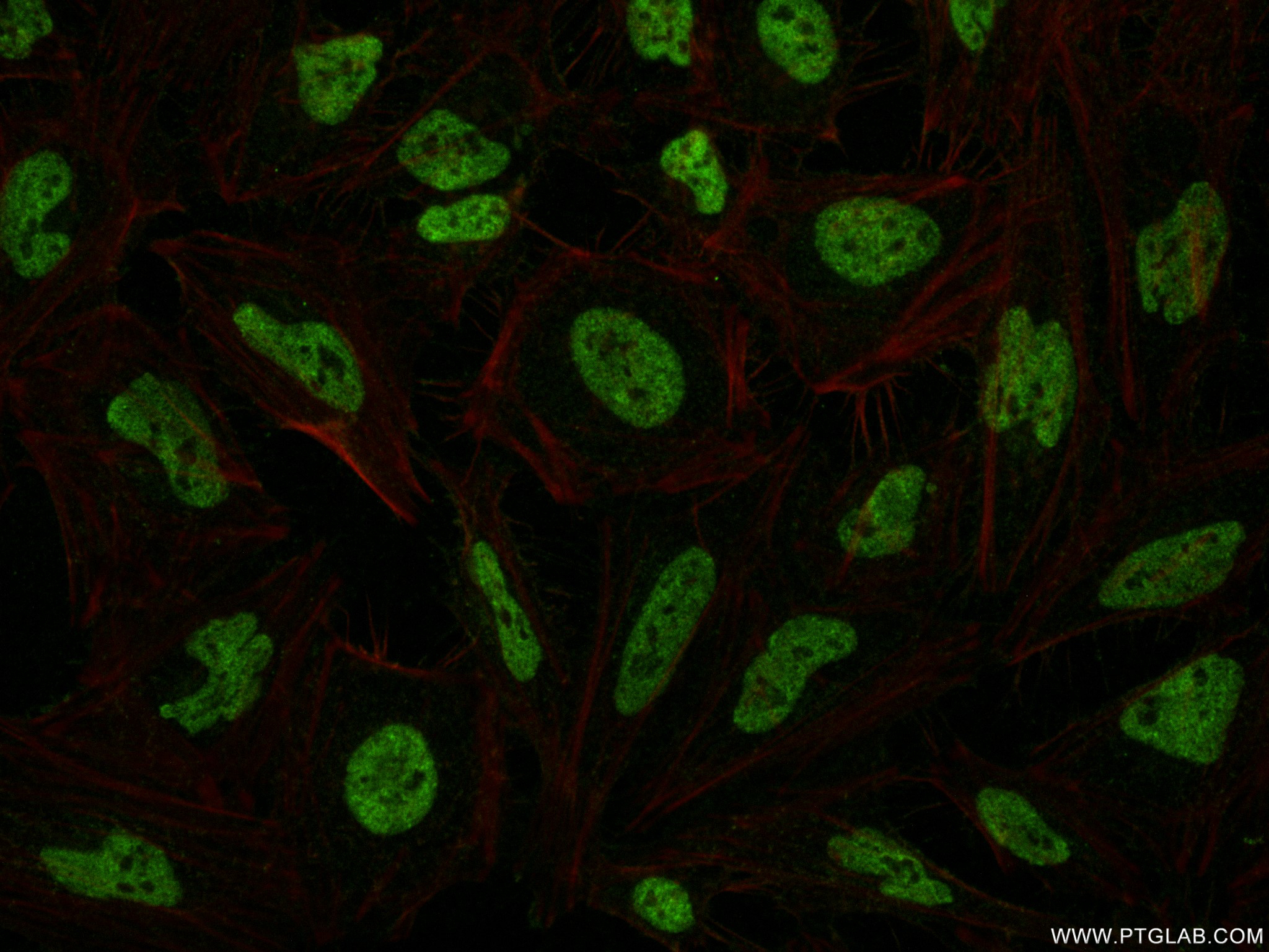 Immunofluorescence (IF) / fluorescent staining of HeLa cells using Di/Tri-Methyl-Histone H3 (Lys4) Recombinant antibo (84908-2-RR)