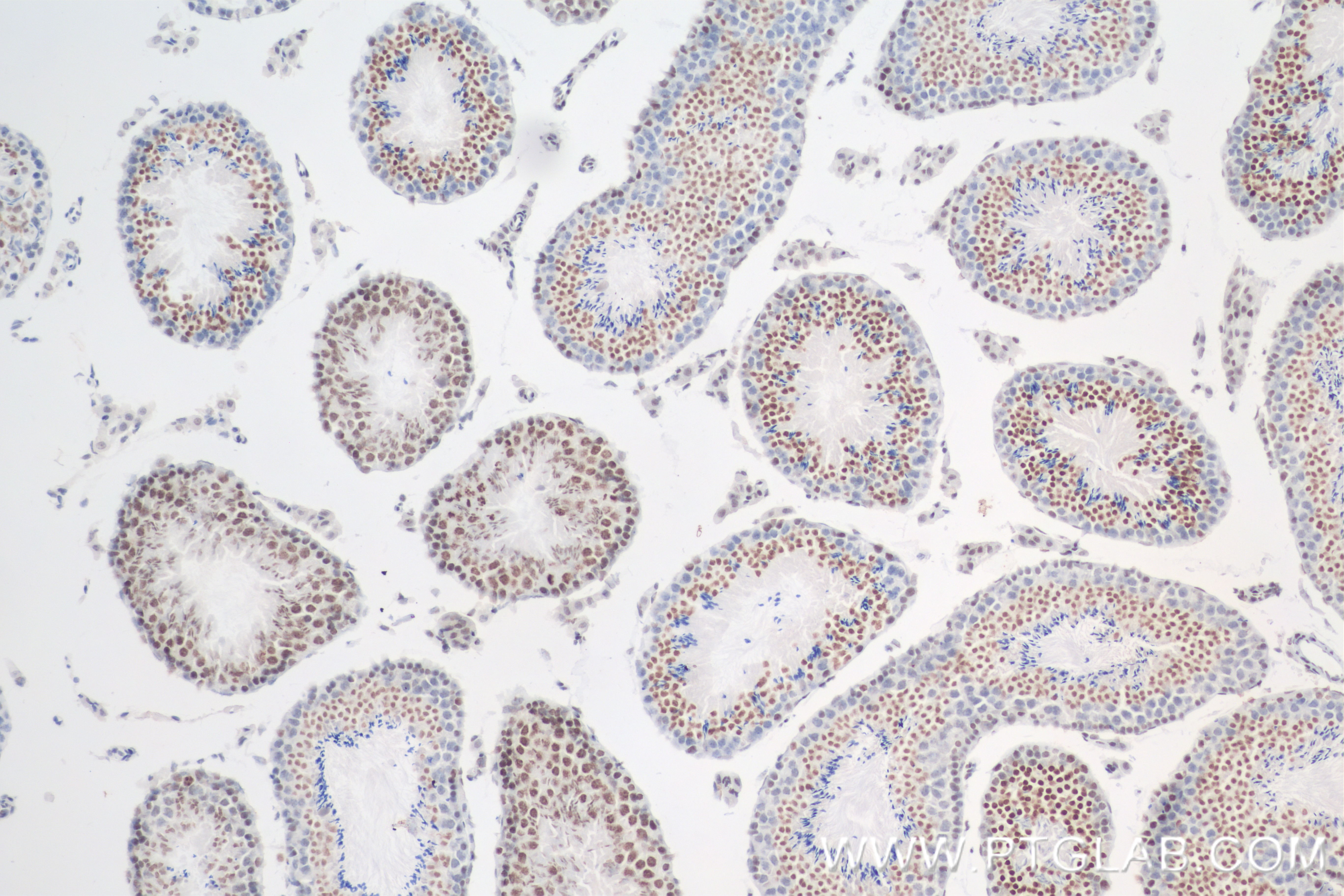 Immunohistochemistry (IHC) staining of mouse testis tissue using Di/Tri-Methyl-Histone H3 (Lys4) Recombinant antibo (84908-2-RR)