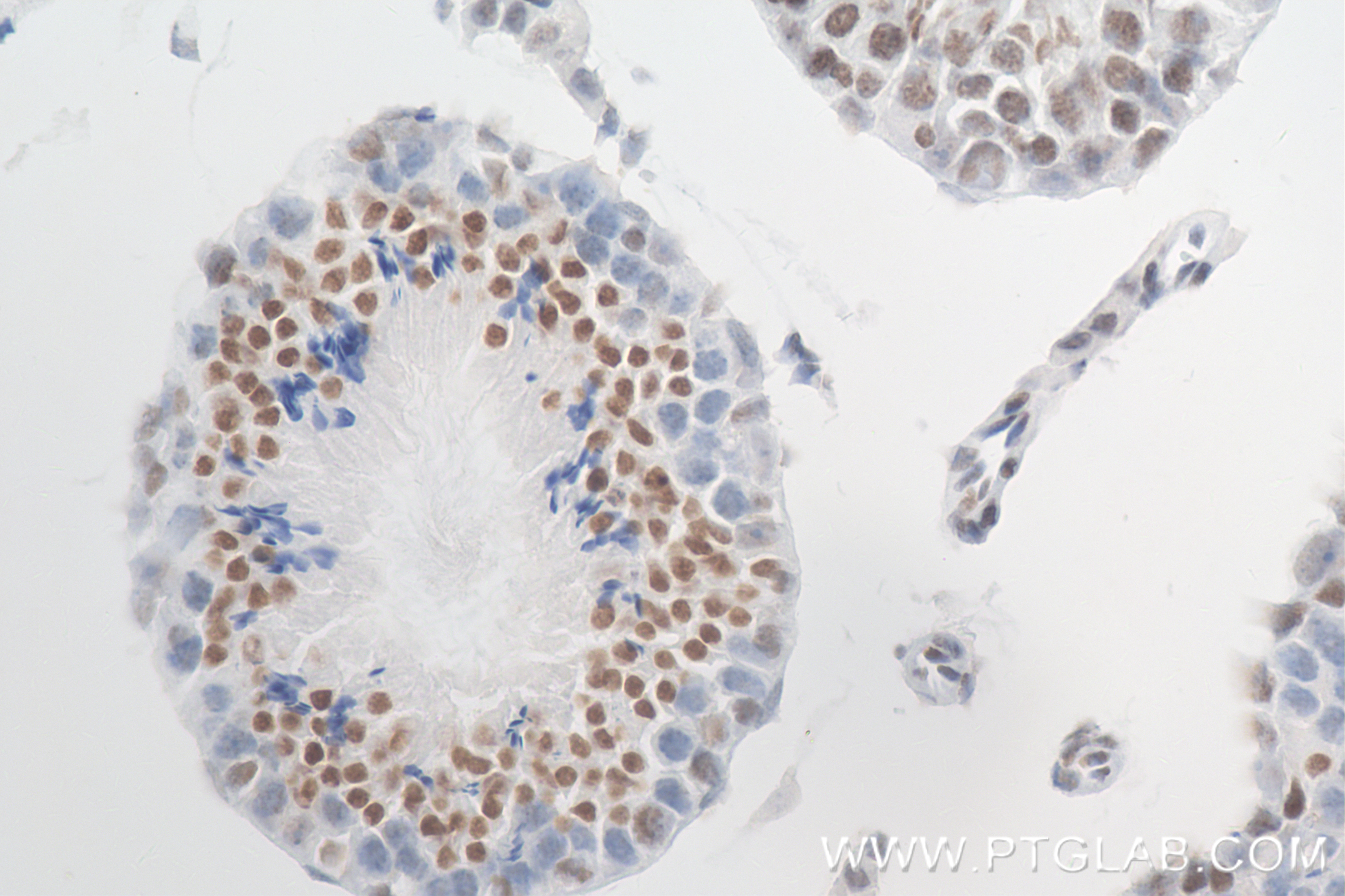 Immunohistochemistry (IHC) staining of mouse testis tissue using Di/Tri-Methyl-Histone H3 (Lys4) Recombinant antibo (84908-2-RR)