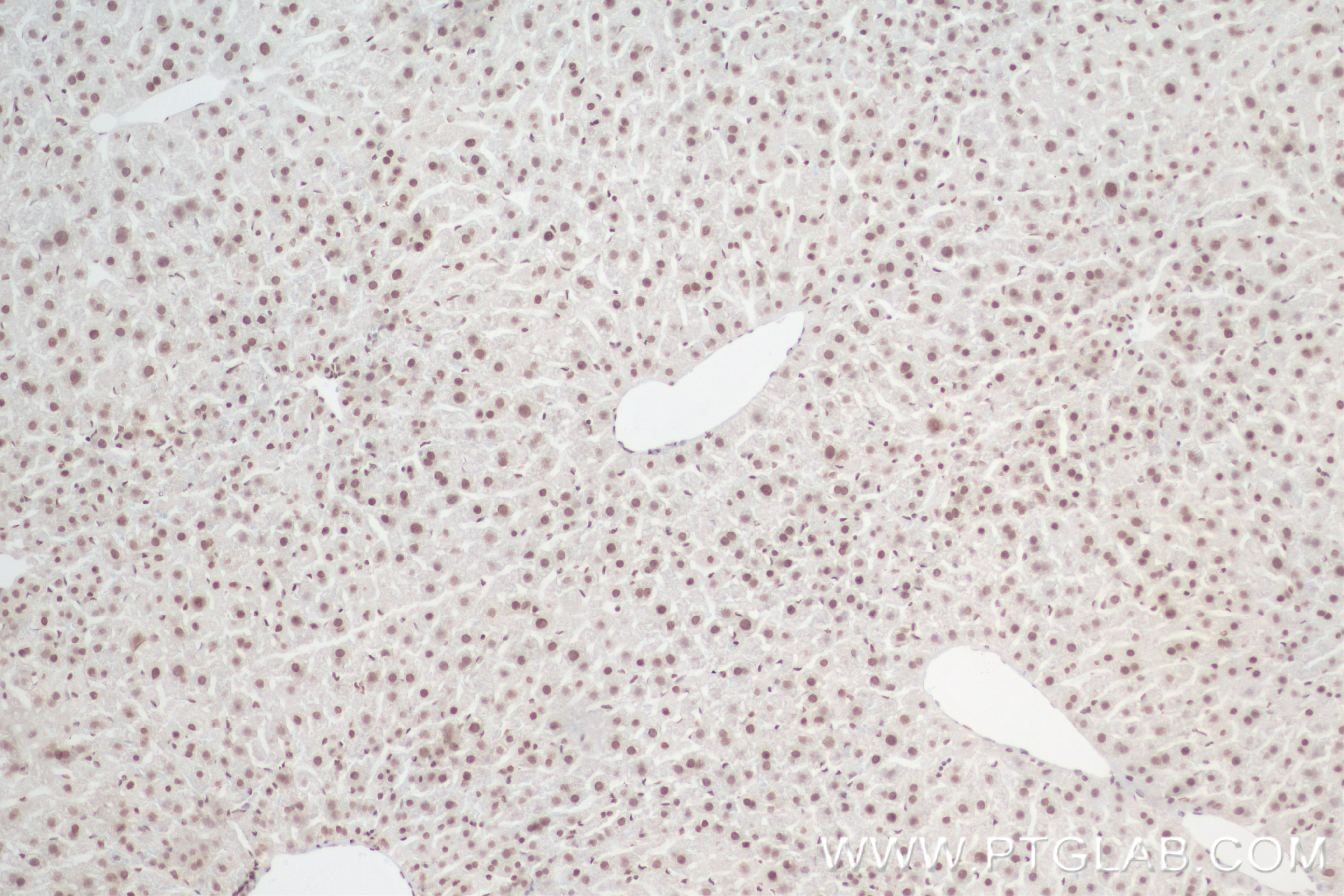 Immunohistochemistry (IHC) staining of mouse liver tissue using Di/Tri-Methyl-Histone H3 (Lys4) Recombinant antibo (84908-2-RR)