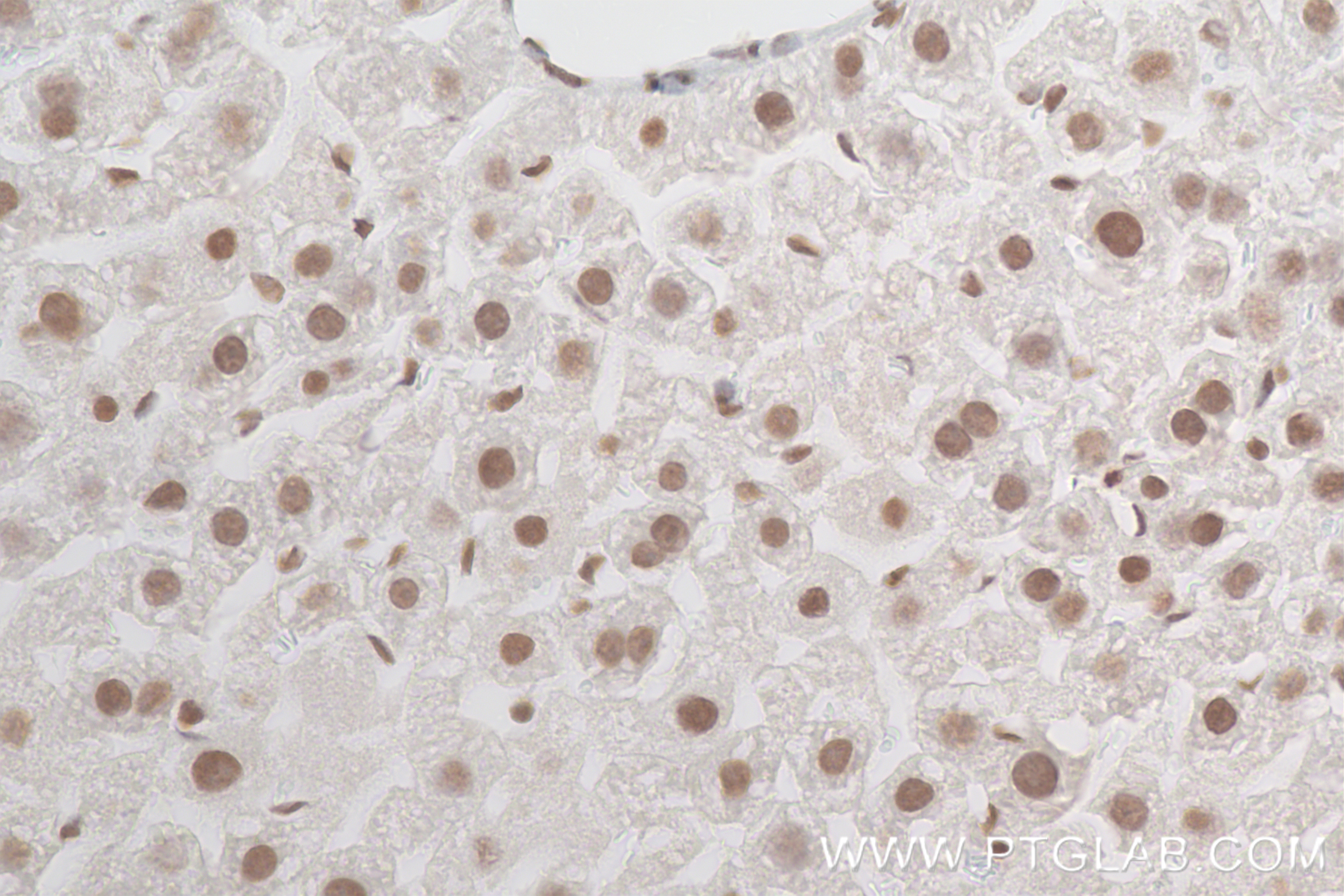 Immunohistochemistry (IHC) staining of mouse liver tissue using Di/Tri-Methyl-Histone H3 (Lys4) Recombinant antibo (84908-2-RR)