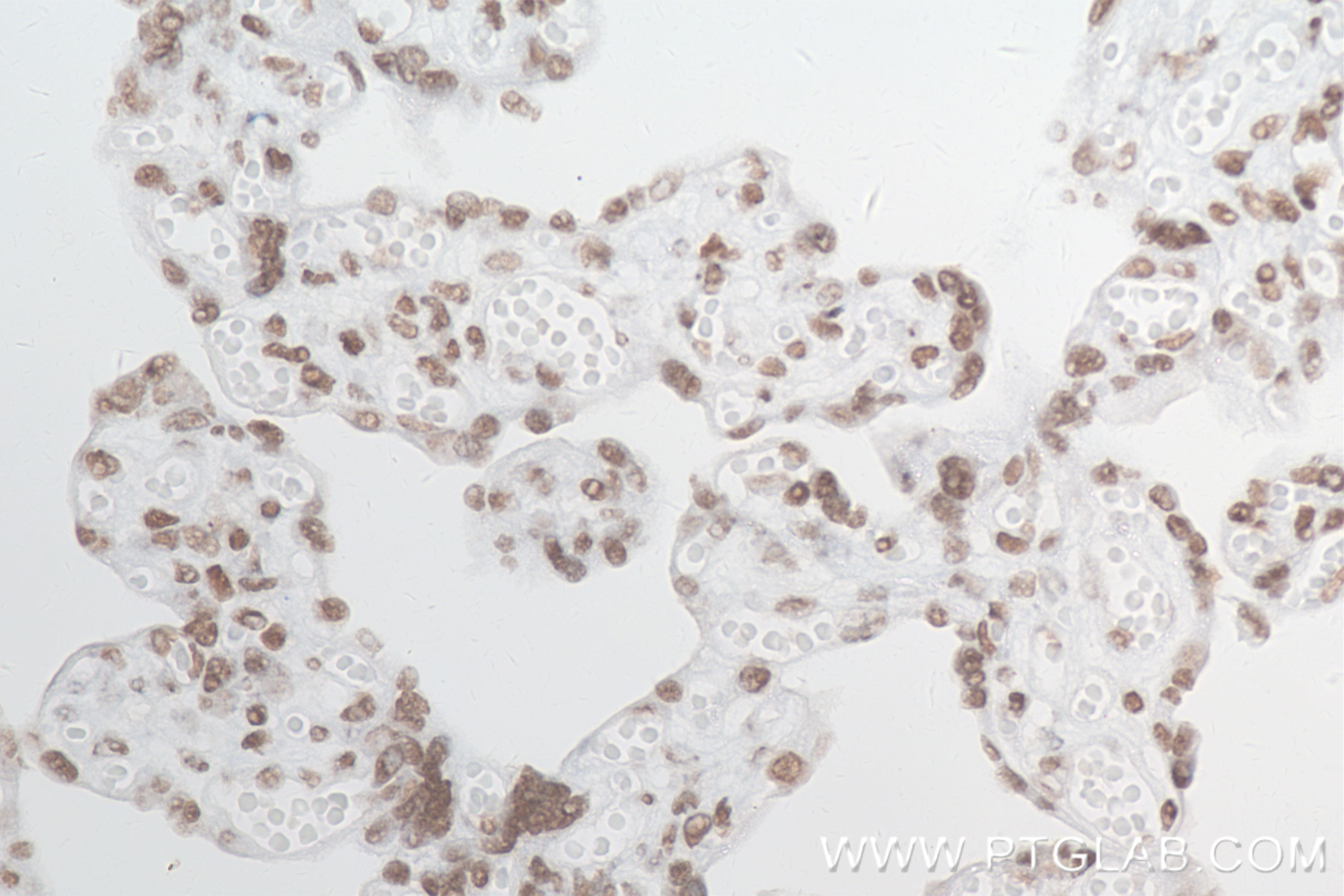 Immunohistochemistry (IHC) staining of human placenta tissue using Di/Tri-Methyl-Histone H3 (Lys4) Recombinant antibo (84908-2-RR)