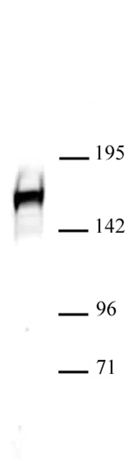 Drosha antibody (pAb) tested by Western blot. HeLa cell nuclear extract (40 ug) probed with Drosha antibody at a dilution of 1:500.