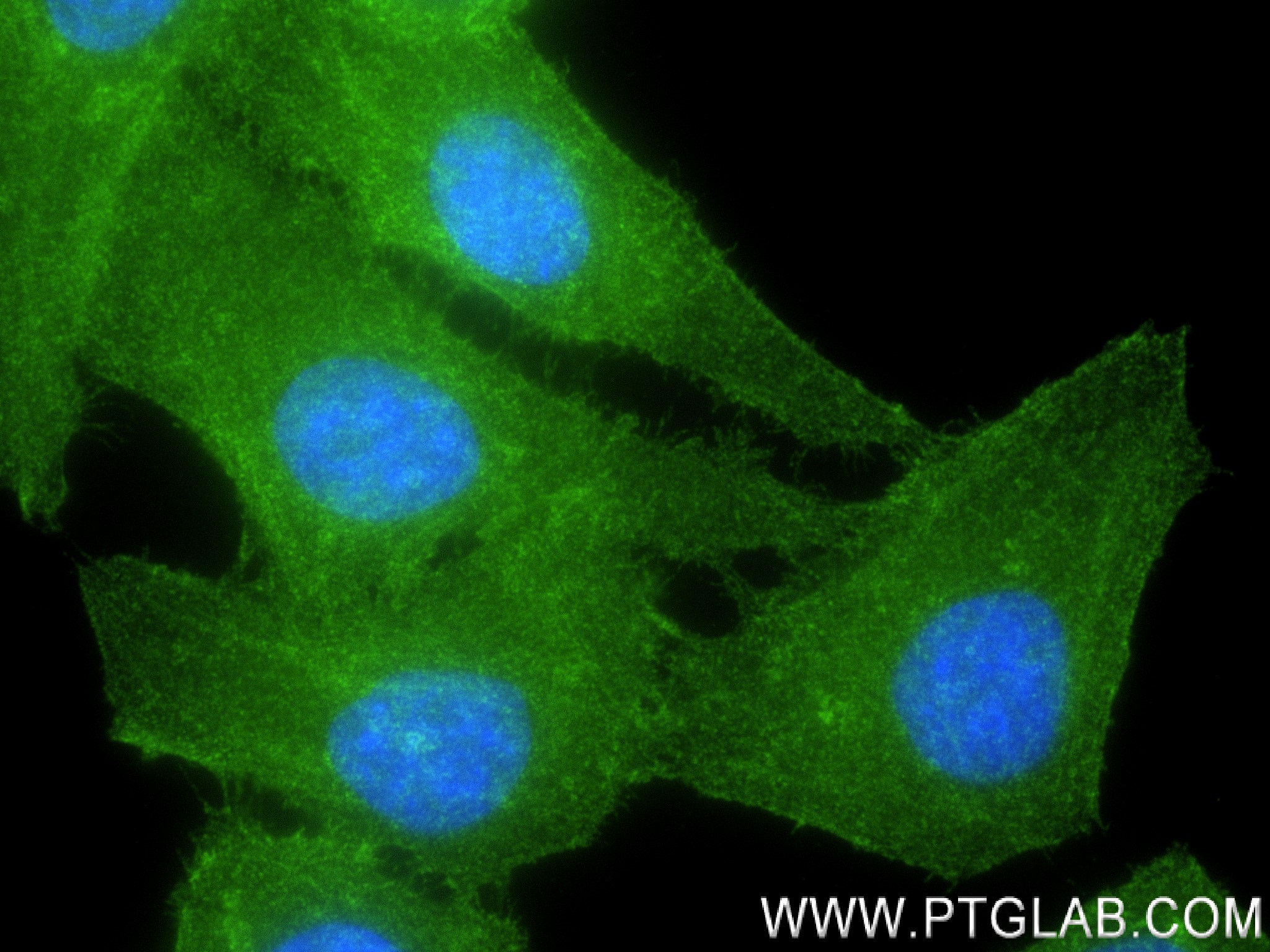 Immunofluorescence (IF) / fluorescent staining of HepG2 cells using Dystrophin Recombinant antibody (83609-5-RR)