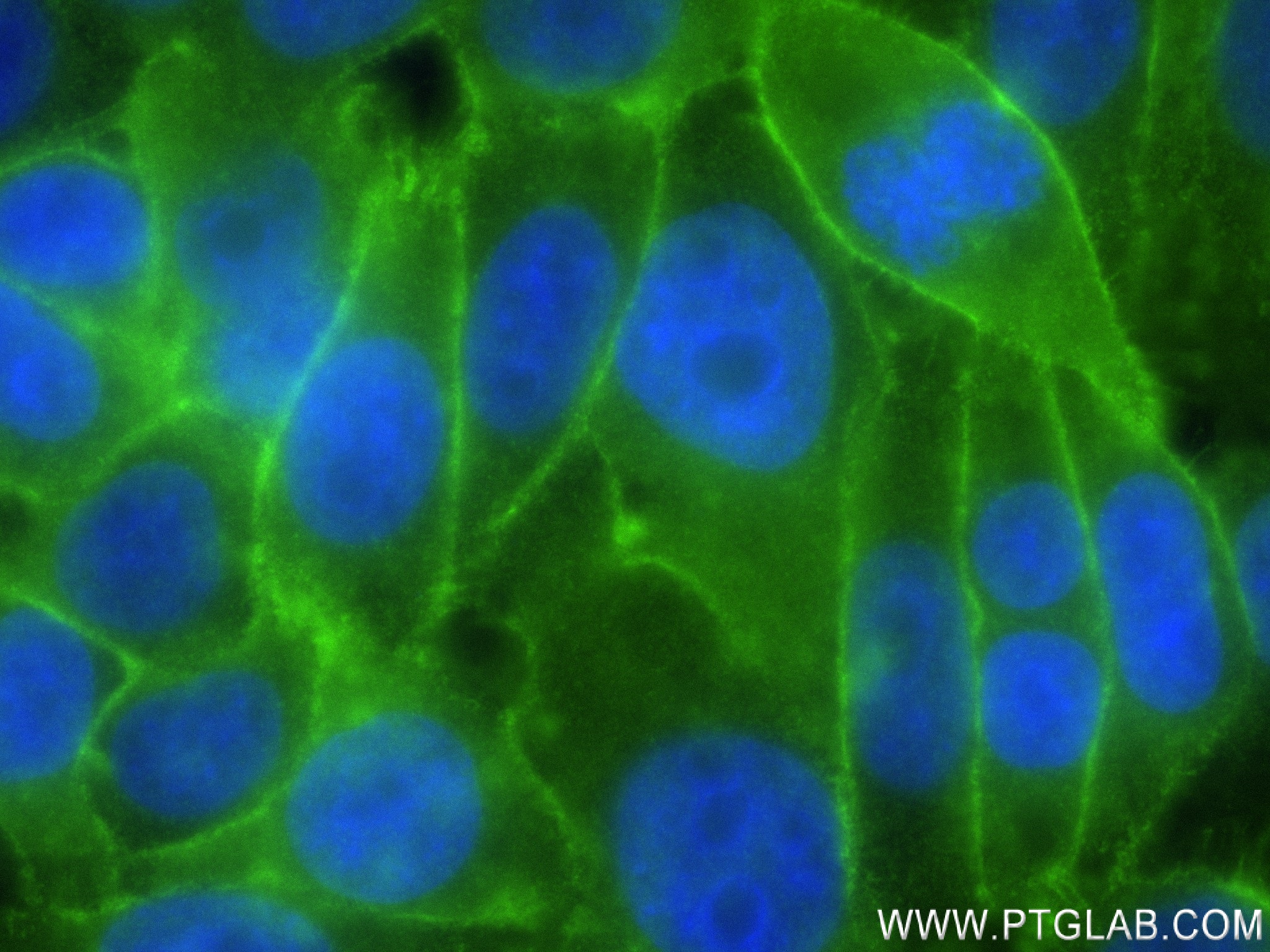 Immunofluorescence (IF) / fluorescent staining of HepG2 cells using Dystrophin Recombinant antibody (83609-5-RR)