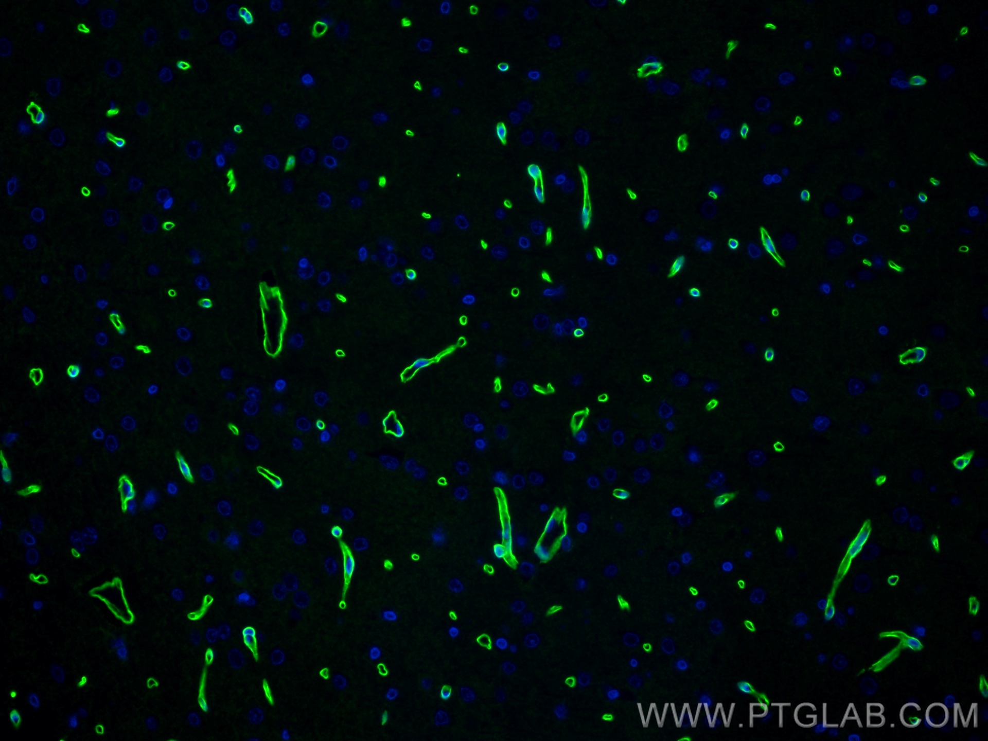 Immunofluorescence (IF) / fluorescent staining of rat brain tissue using Dystrophin Recombinant antibody (83609-5-RR)