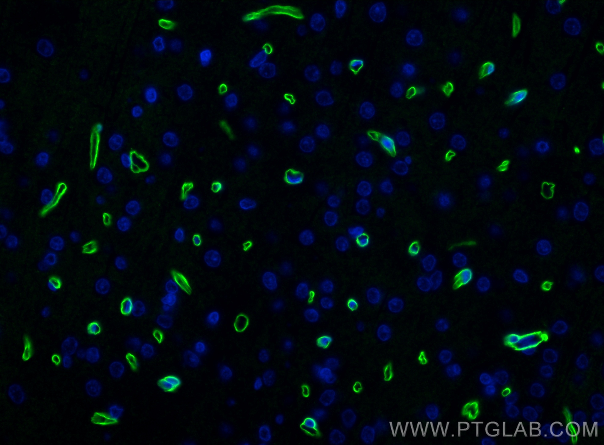 Immunofluorescence (IF) / fluorescent staining of rat brain tissue using Dystrophin Recombinant antibody (83609-5-RR)