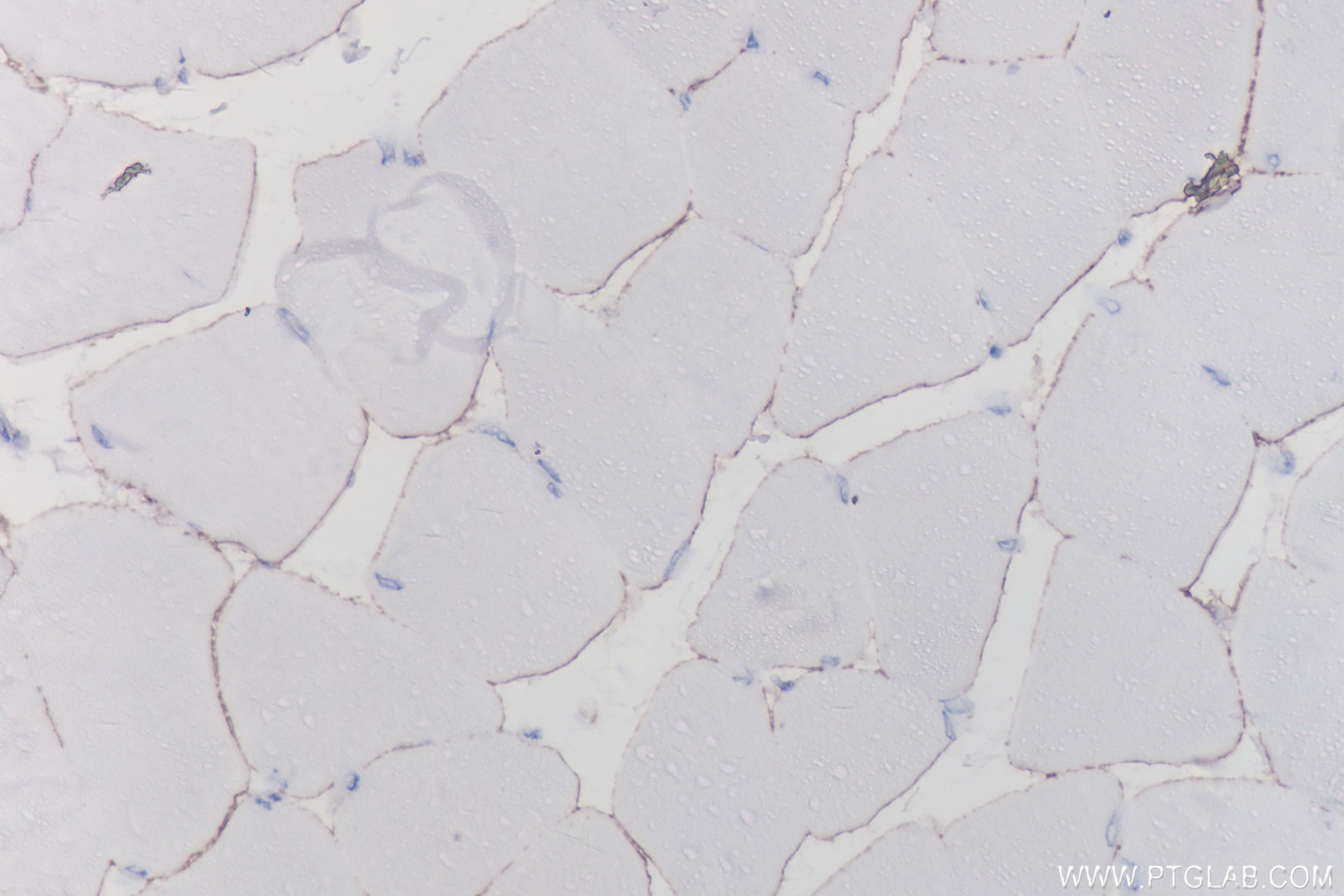 Immunohistochemistry (IHC) staining of mouse skeletal muscle tissue using Dystrophin Recombinant antibody (83609-5-RR)