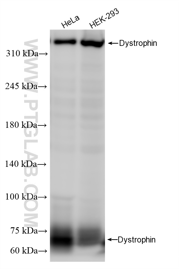 Western Blot (WB) analysis of various lysates using Dystrophin Recombinant antibody (83609-5-RR)