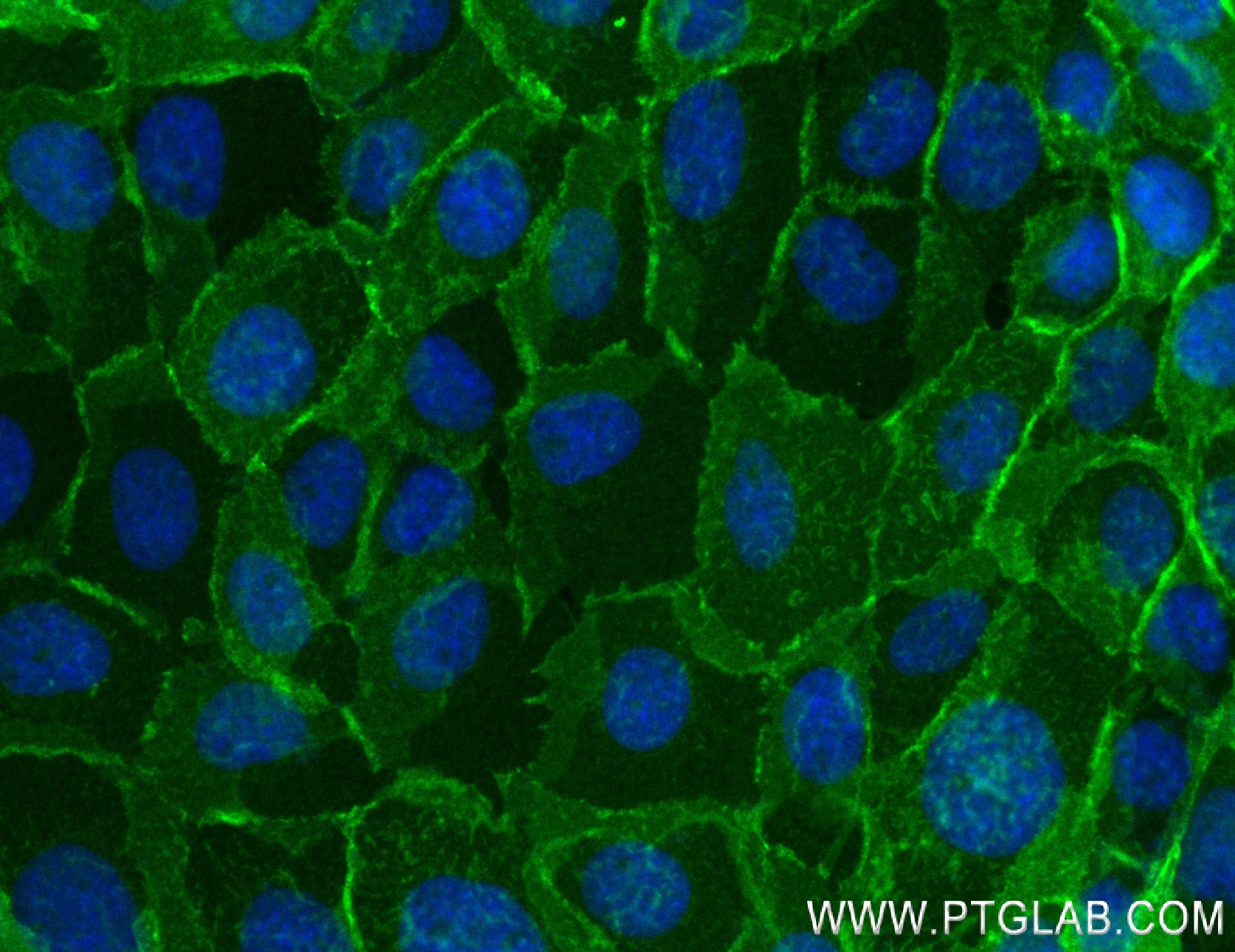 Immunofluorescence (IF) / fluorescent staining of A431 cells using E-Cadherin Recombinant antibody (84111-2-RR)