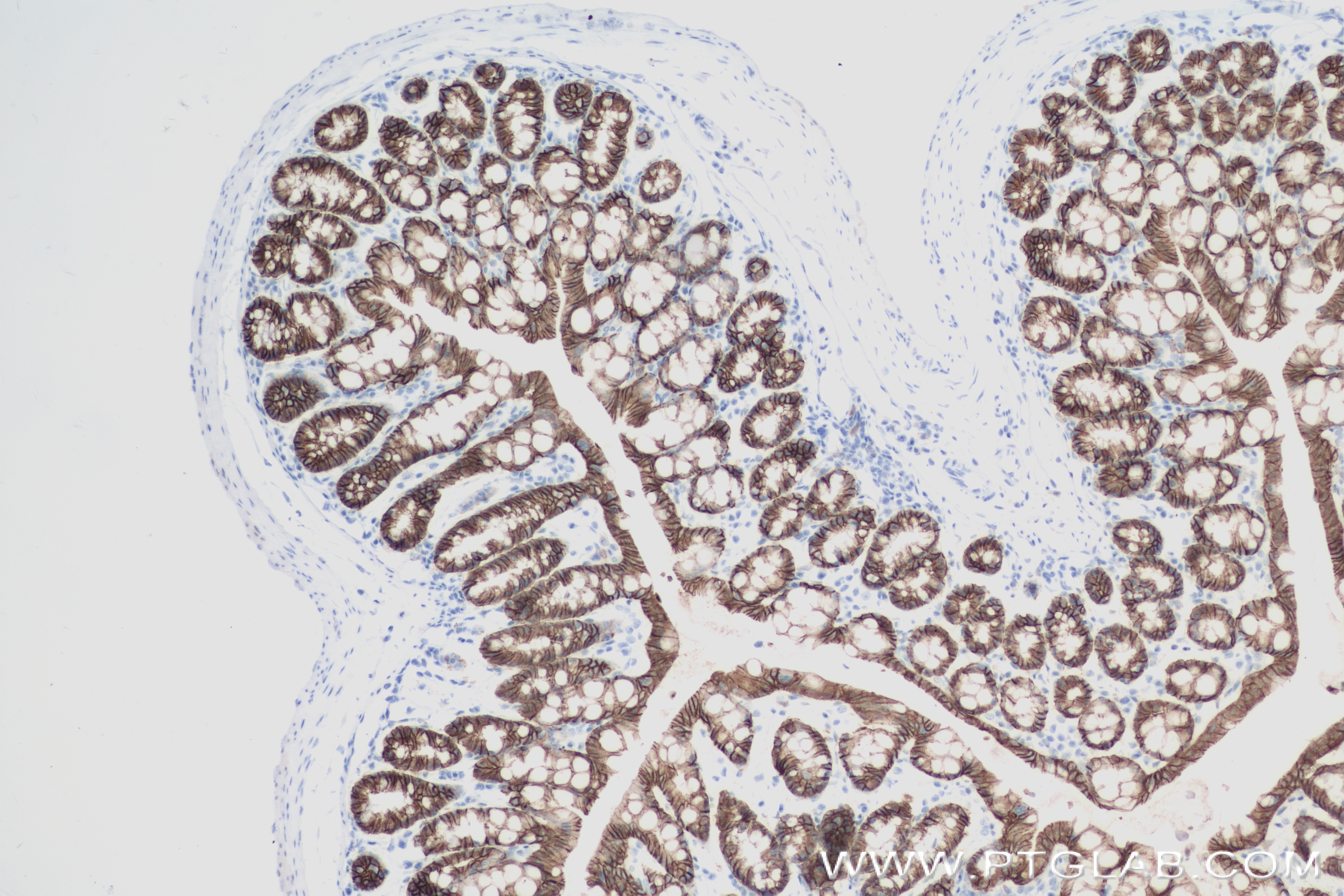 Immunohistochemistry (IHC) staining of mouse colon tissue using E-Cadherin Recombinant antibody (84111-2-RR)