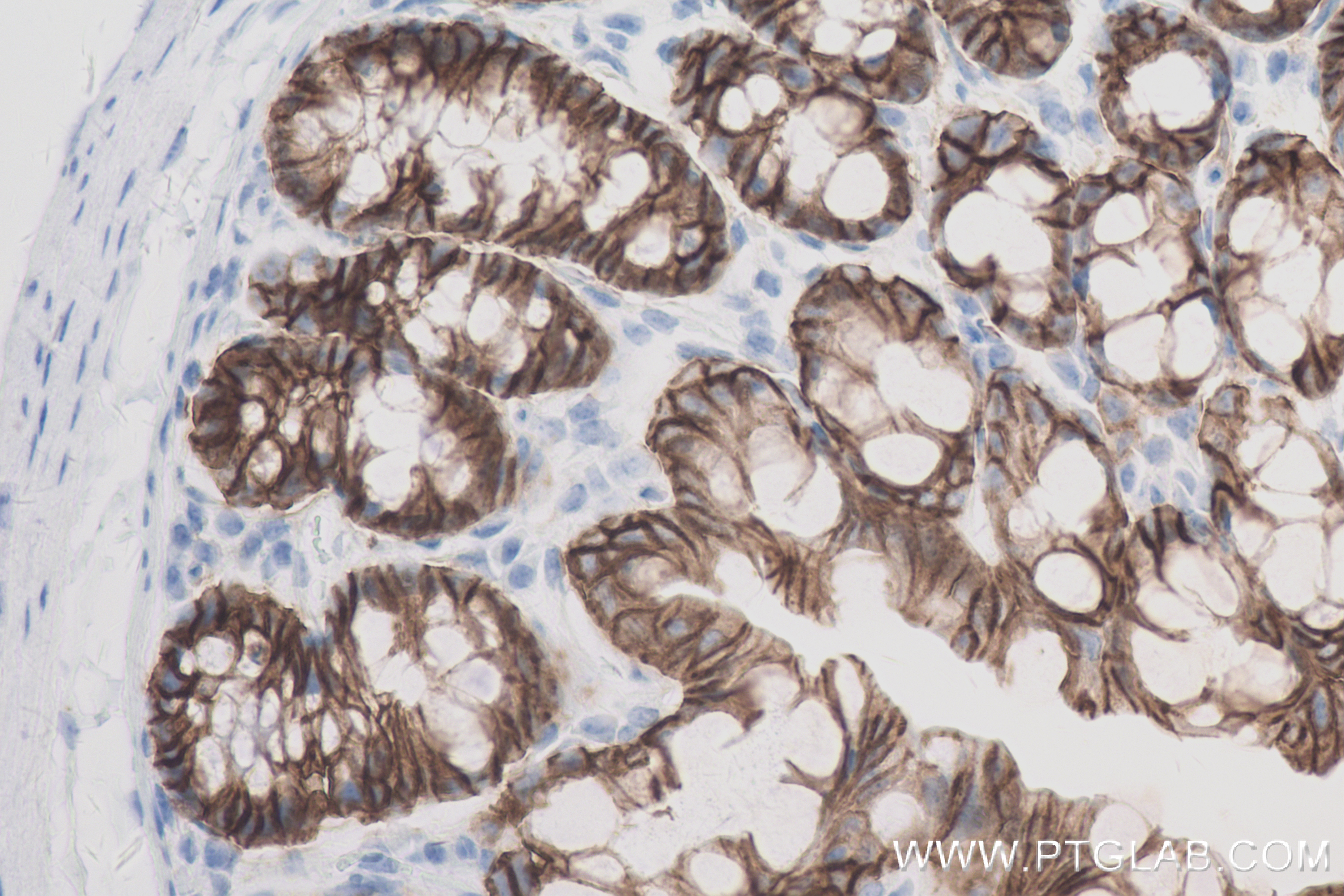 Immunohistochemistry (IHC) staining of mouse colon tissue using E-Cadherin Recombinant antibody (84111-2-RR)