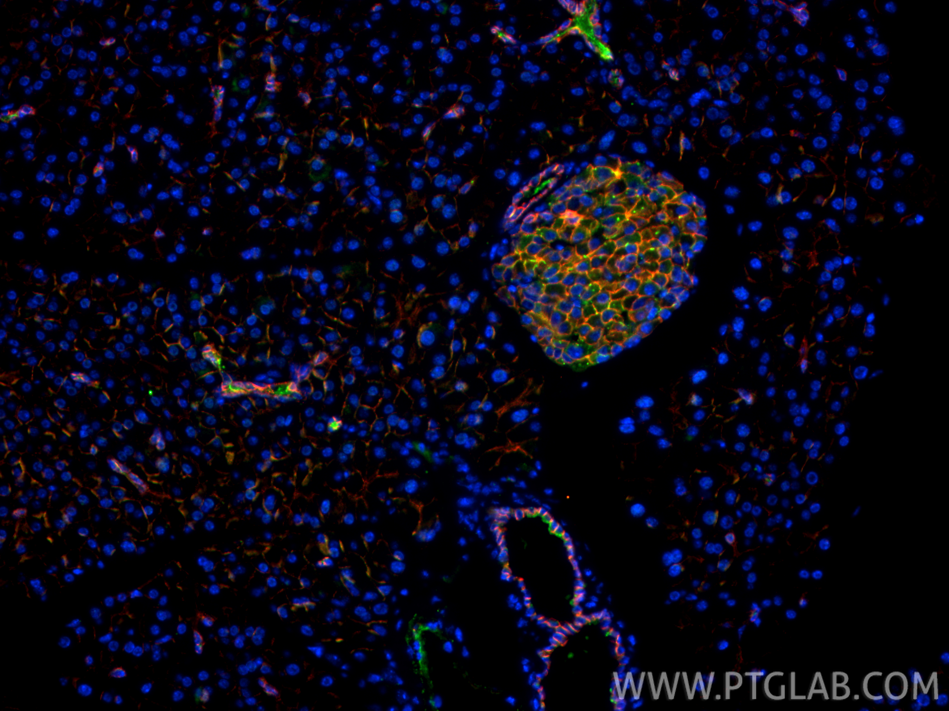 Immunofluorescence (IF) / fluorescent staining of mouse pancreas tissue using E-cadherin Polyclonal antibody (20874-1-AP)