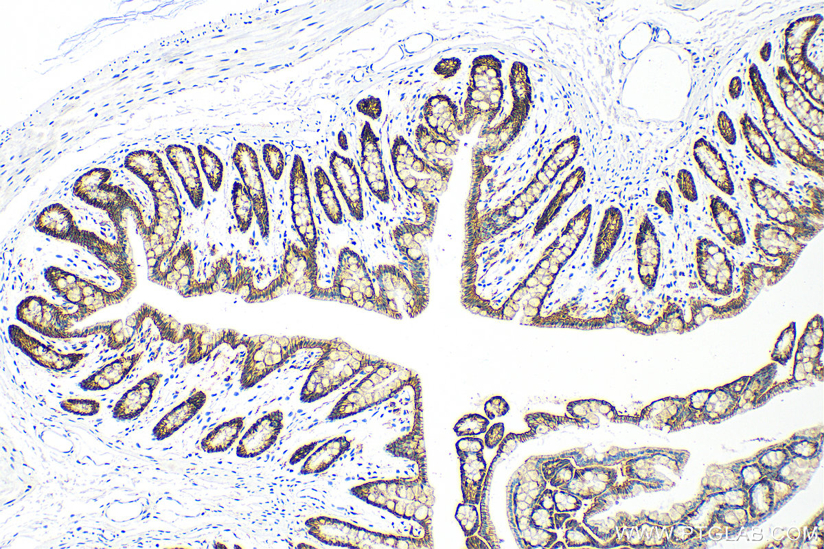 Immunohistochemistry (IHC) staining of rat colon tissue using E-cadherin Polyclonal antibody (20874-1-AP)