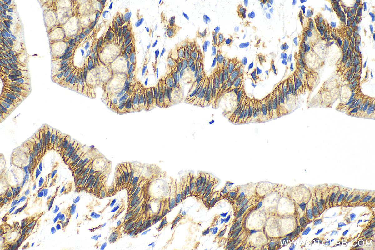 Immunohistochemistry (IHC) staining of rat colon tissue using E-cadherin Polyclonal antibody (20874-1-AP)