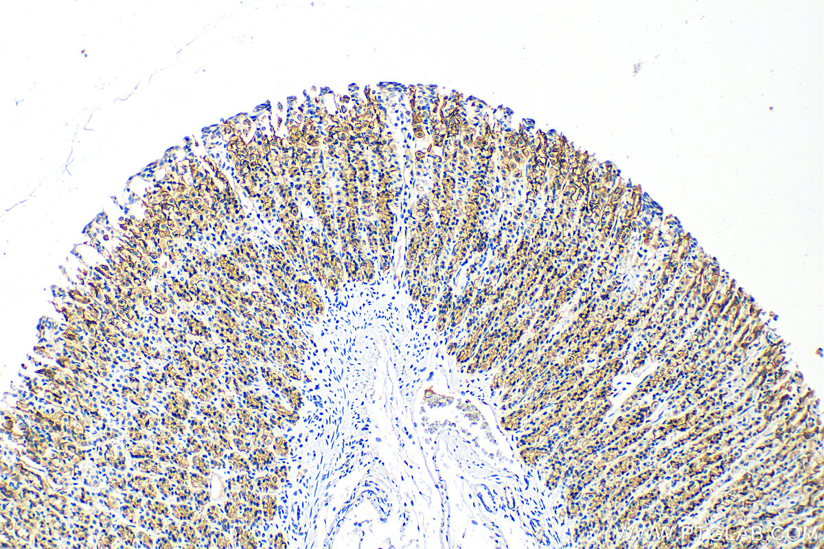 Immunohistochemistry (IHC) staining of rat stomach tissue using E-cadherin Polyclonal antibody (20874-1-AP)