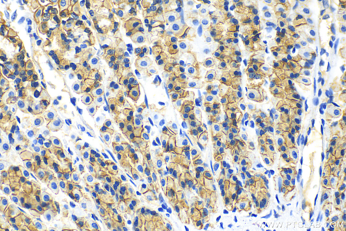 Immunohistochemistry (IHC) staining of rat stomach tissue using E-cadherin Polyclonal antibody (20874-1-AP)