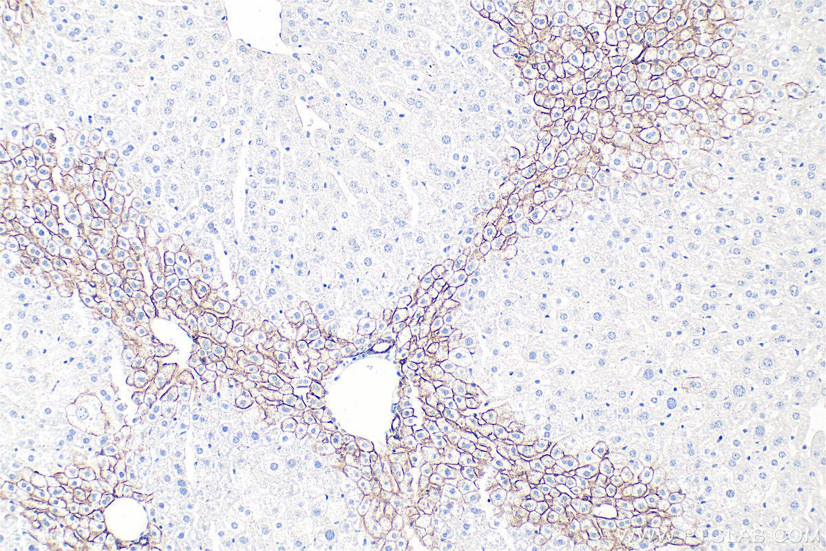 Immunohistochemistry (IHC) staining of mouse liver tissue using E-cadherin Polyclonal antibody (20874-1-AP)
