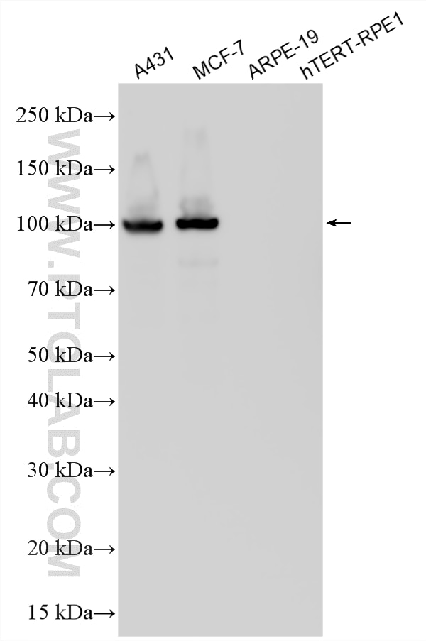 Western Blot (WB) analysis of various lysates using E-cadherin Polyclonal antibody (20874-1-AP)