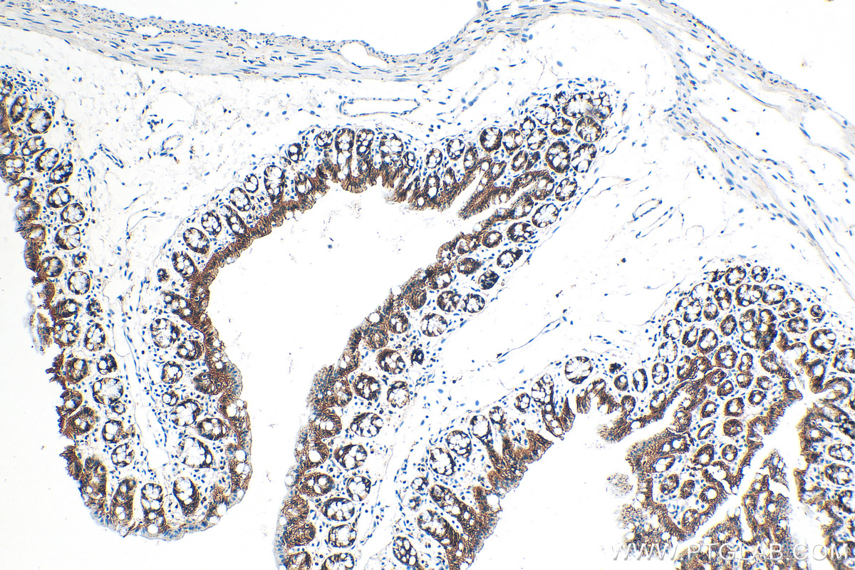 Immunohistochemistry (IHC) staining of mouse colon tissue using E-cadherin Polyclonal antibody (31515-1-AP)