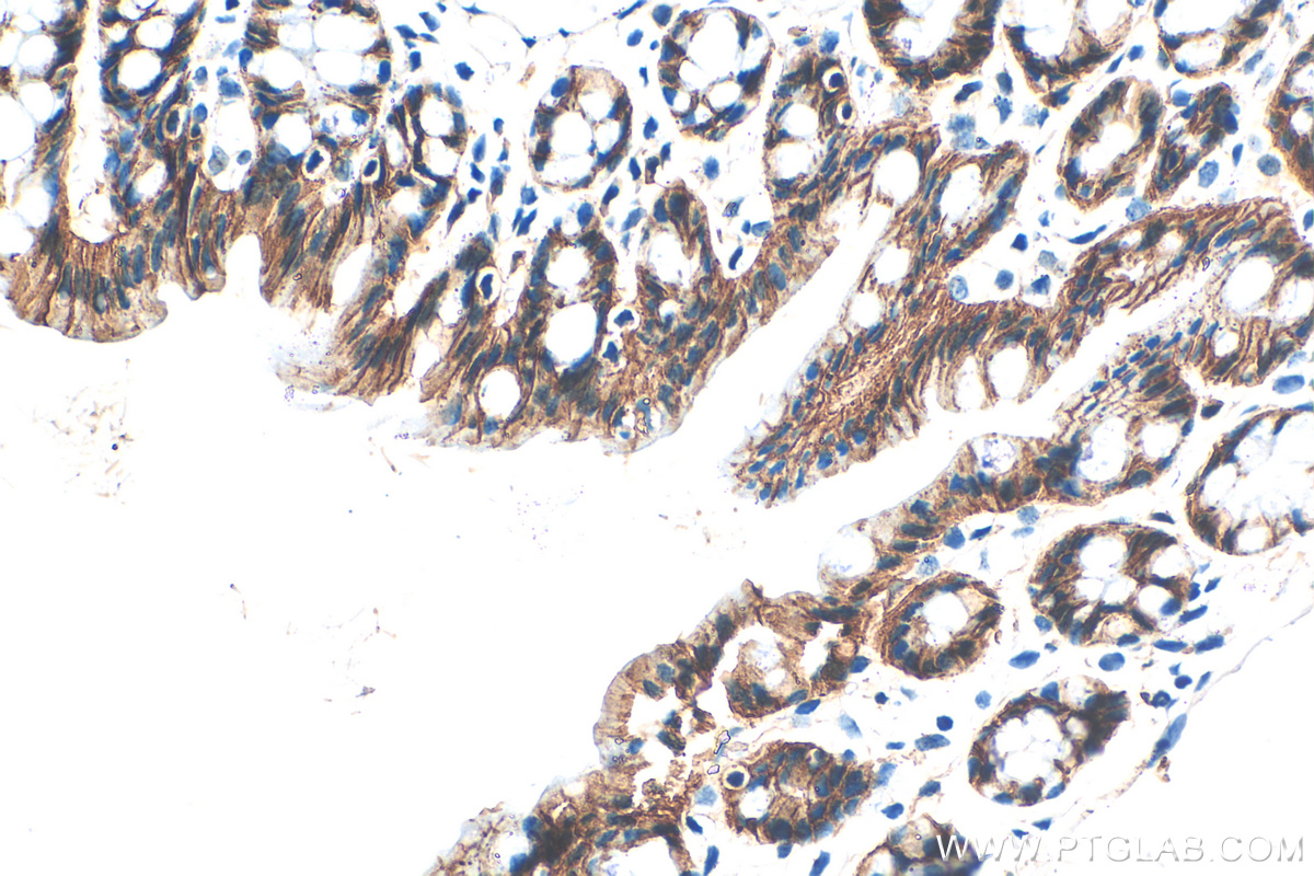 Immunohistochemistry (IHC) staining of mouse colon tissue using E-cadherin Polyclonal antibody (31515-1-AP)