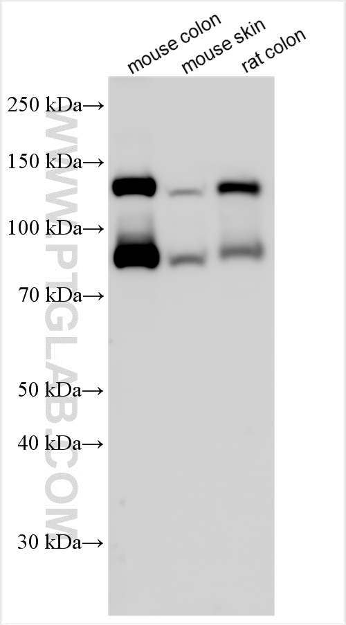 Western Blot (WB) analysis of various lysates using E-cadherin Polyclonal antibody (31515-1-AP)