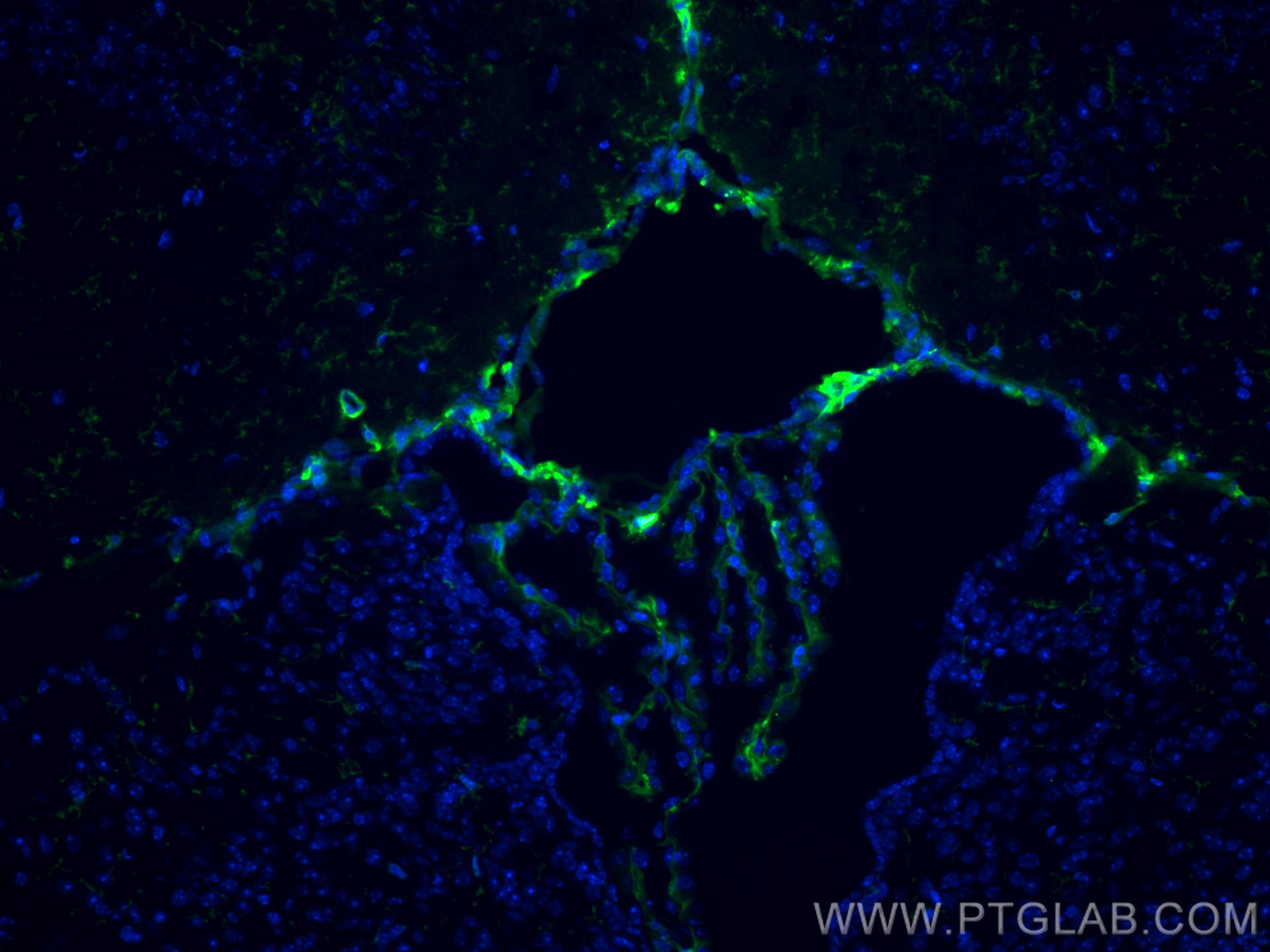 Immunofluorescence (IF) / fluorescent staining of mouse brain tissue using E-cadherin Monoclonal antibody (60335-1-Ig)