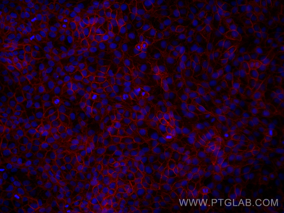 Immunofluorescence (IF) / fluorescent staining of HaCaT cells using E-cadherin Monoclonal antibody (60335-1-Ig)