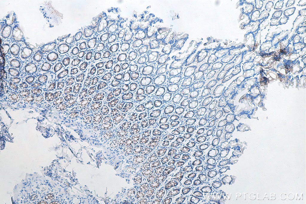Immunohistochemistry (IHC) staining of rat colon tissue using E-cadherin Monoclonal antibody (60335-1-Ig)