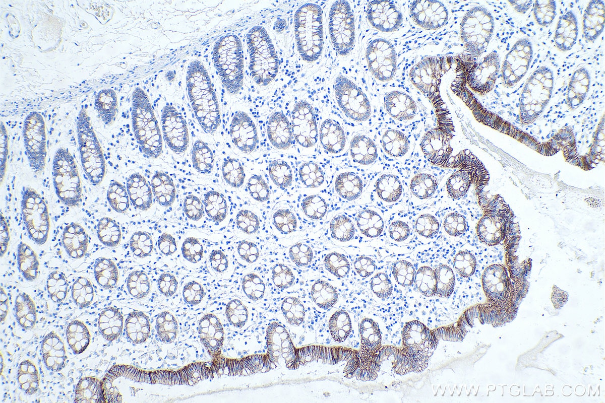 Immunohistochemistry (IHC) staining of human colon tissue using E-cadherin Monoclonal antibody (60335-1-Ig)