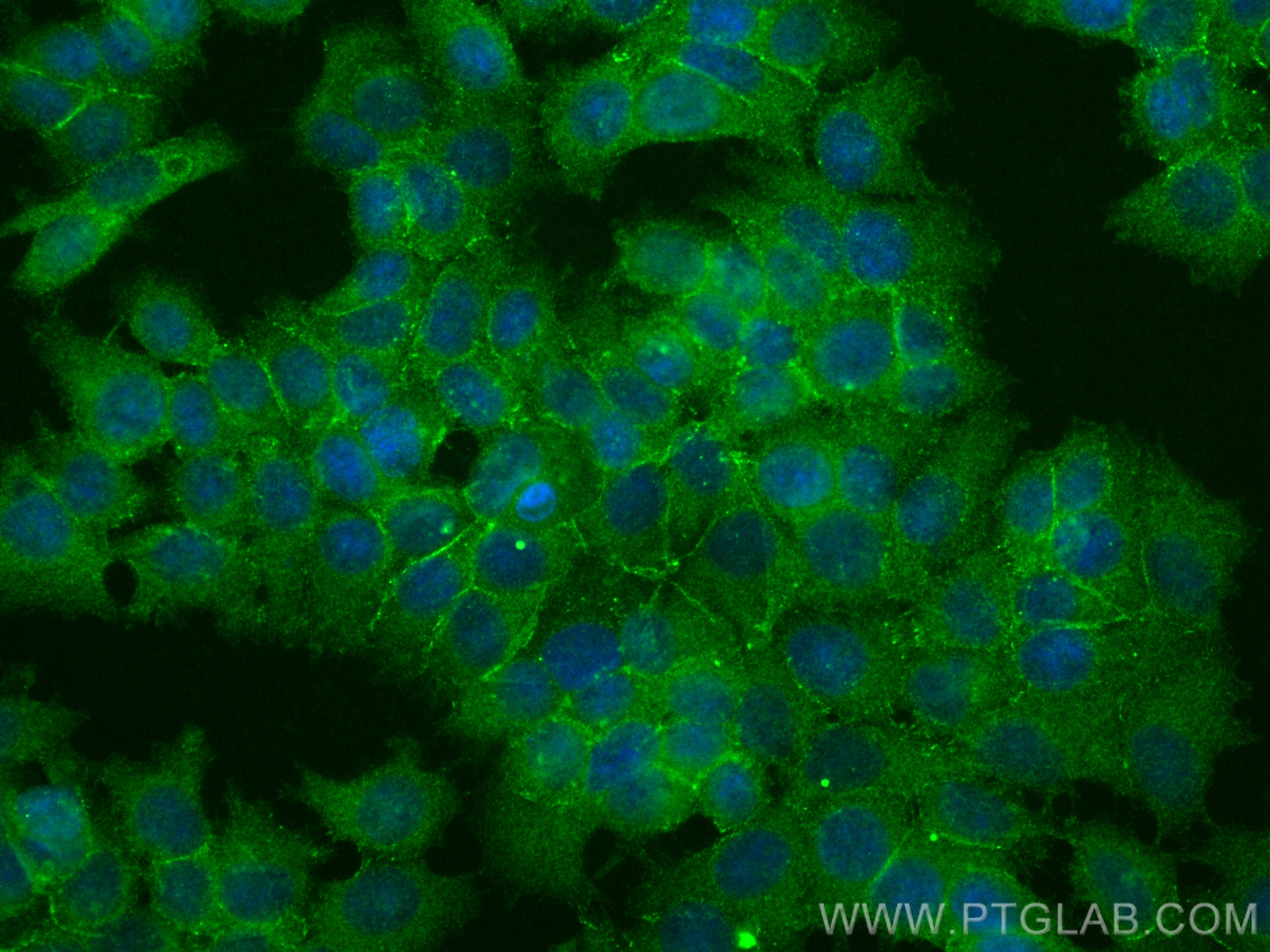 Immunofluorescence (IF) / fluorescent staining of MCF-7 cells using E-cadherin Recombinant antibody (80541-5-RR)