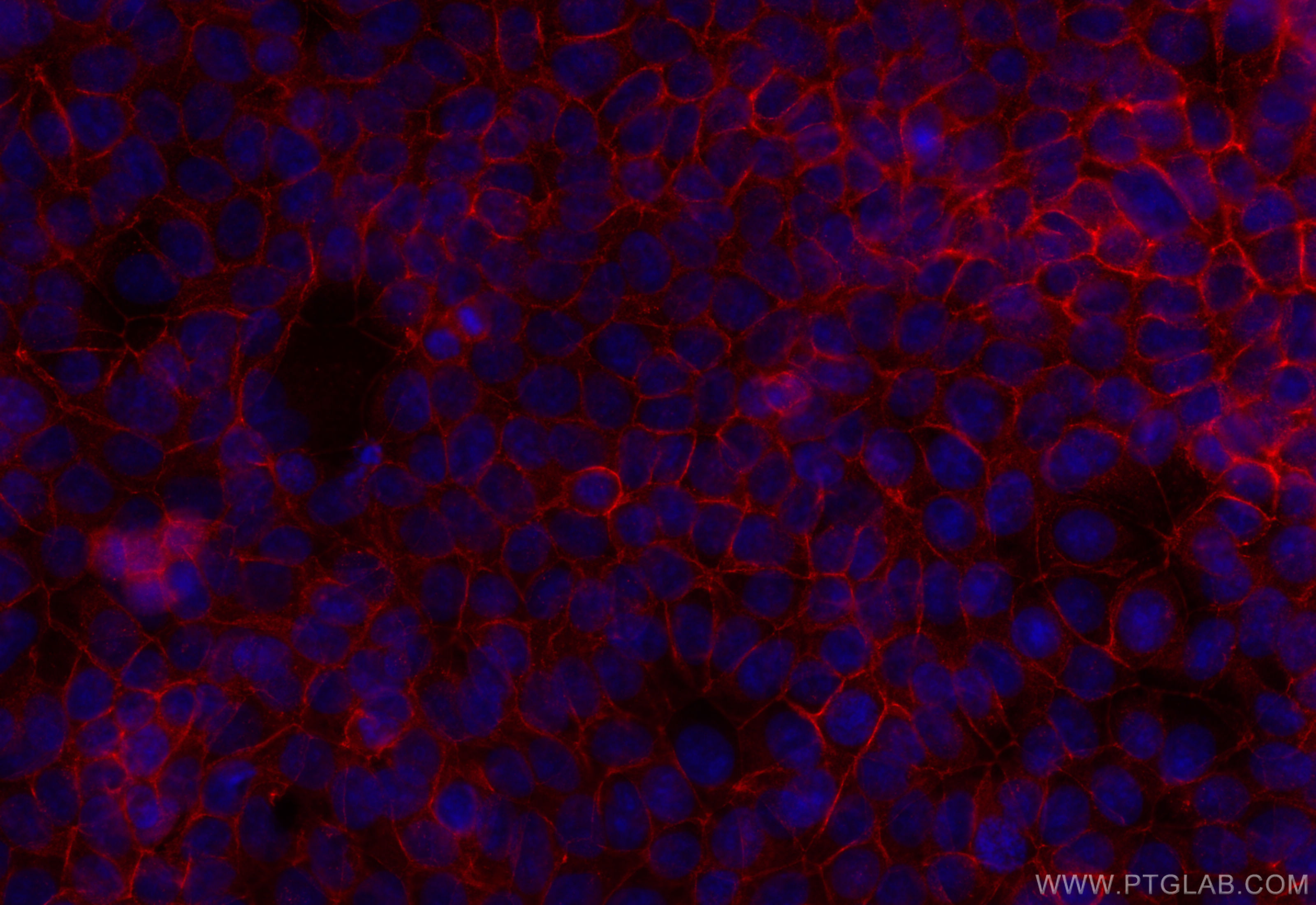 Immunofluorescence (IF) / fluorescent staining of MCF-7 cells using E-cadherin Recombinant antibody (80541-5-RR)