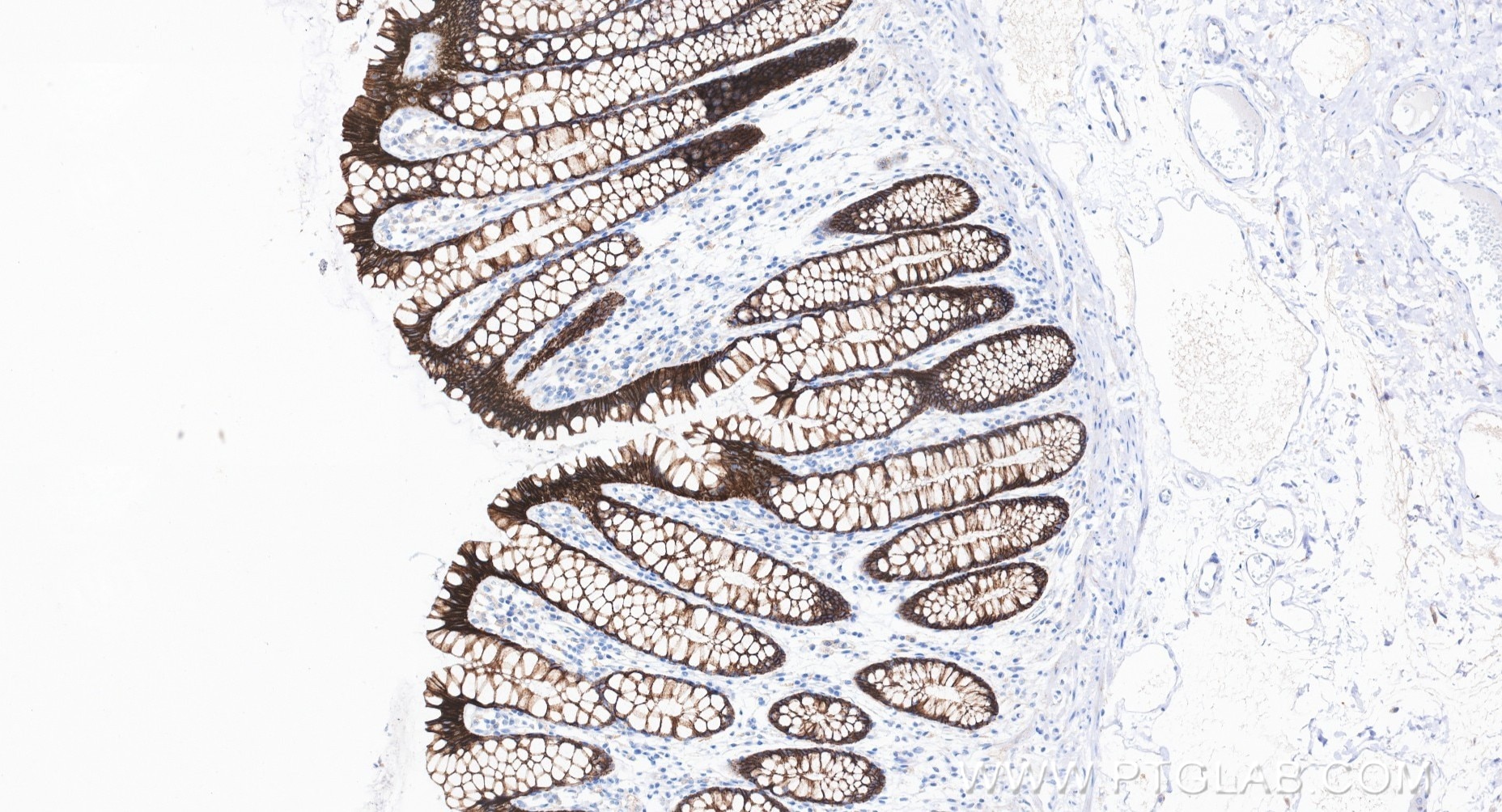 Immunohistochemistry (IHC) staining of human large intestine tissue using E-cadherin Recombinant monoclonal antibody (80541-5-RR)