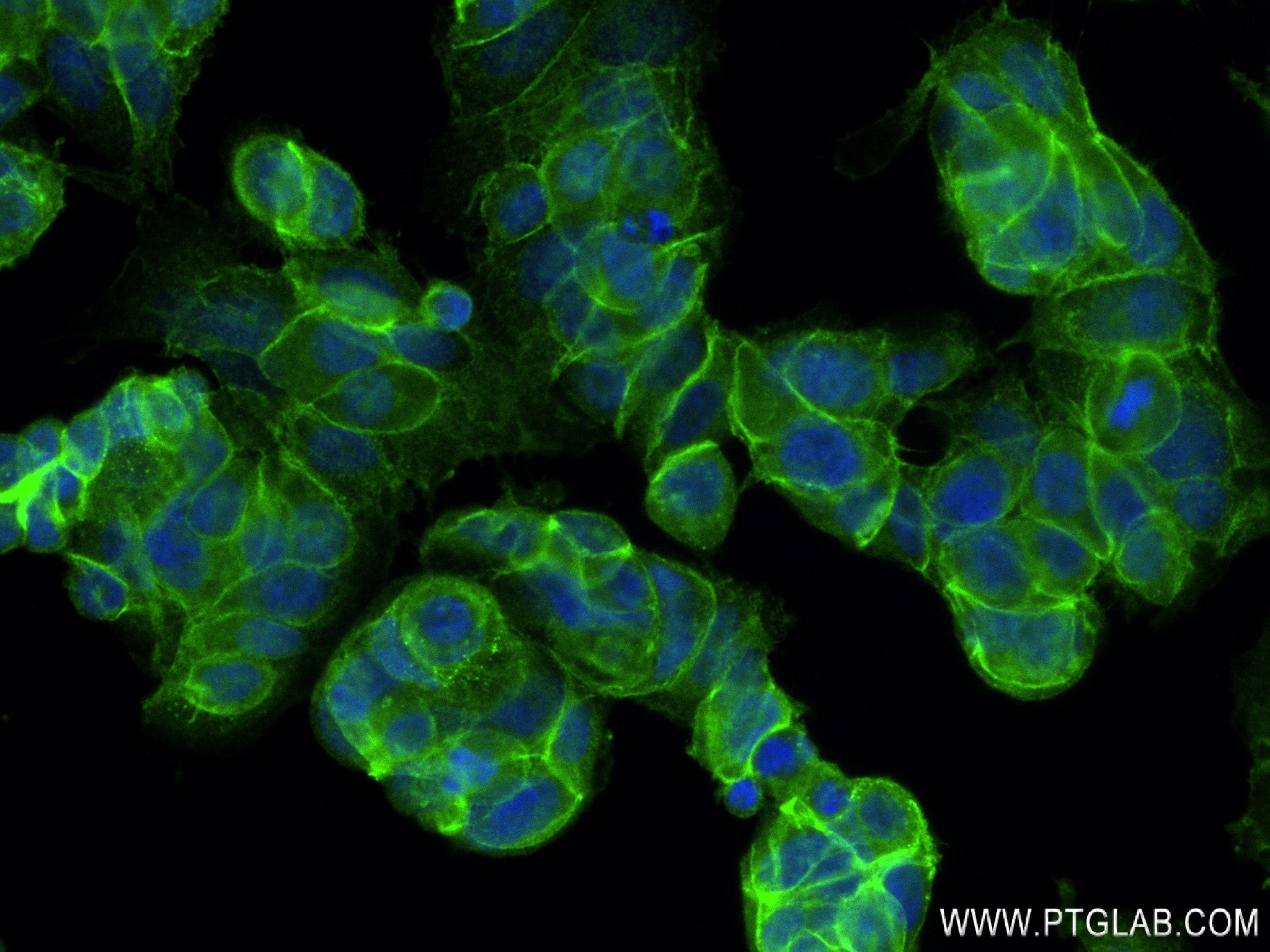 Immunofluorescence (IF) / fluorescent staining of MCF-7 cells using E-cadherin Recombinant antibody (80541-7-RR)