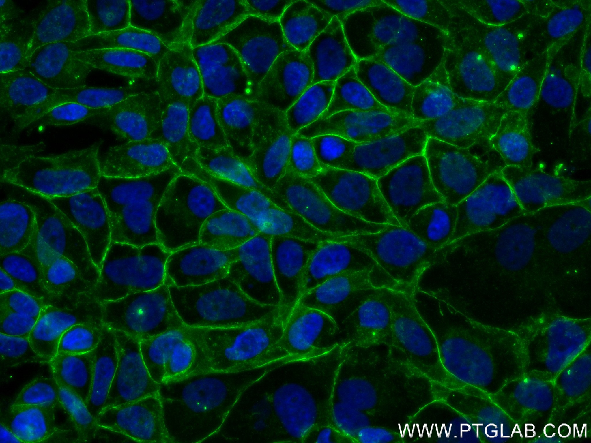 Immunofluorescence (IF) / fluorescent staining of MCF-7 cells using E-cadherin Recombinant antibody (80541-7-RR)