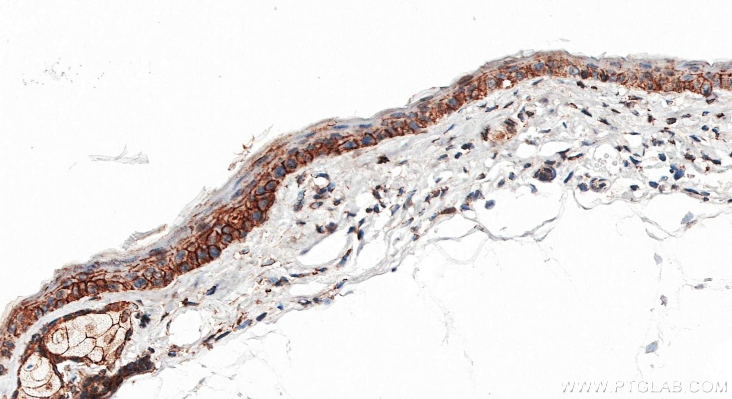 Immunohistochemistry (IHC) staining of mouse skin tissue using E-cadherin Recombinant monoclonal antibody (80541-7-RR)